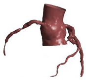 Fluids 06 00053 i020 Fluids 06 00053 i020