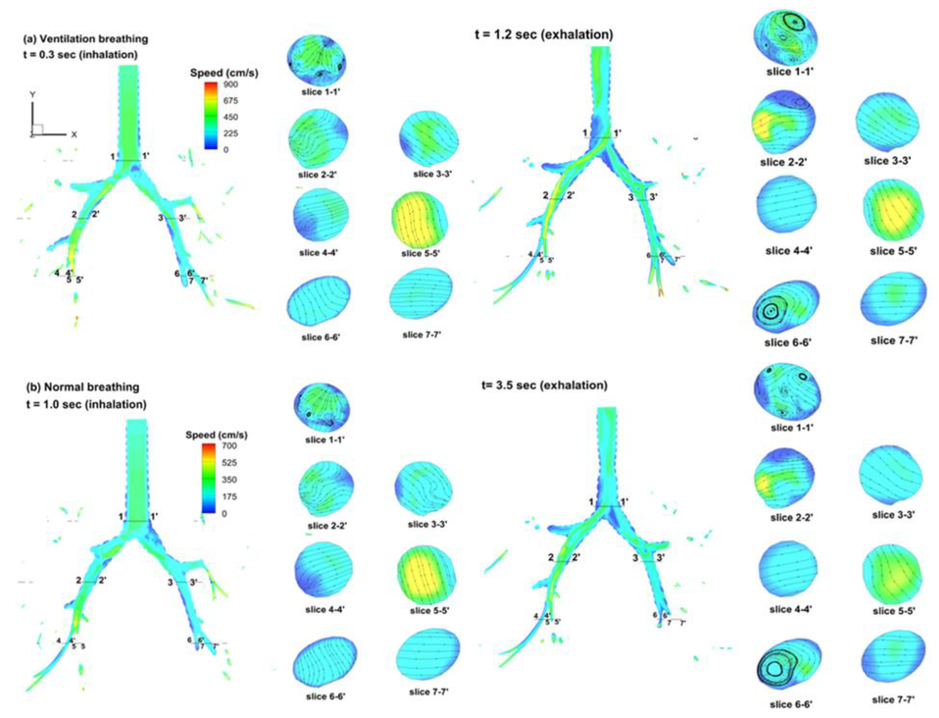 Fluids 06 00388 g005