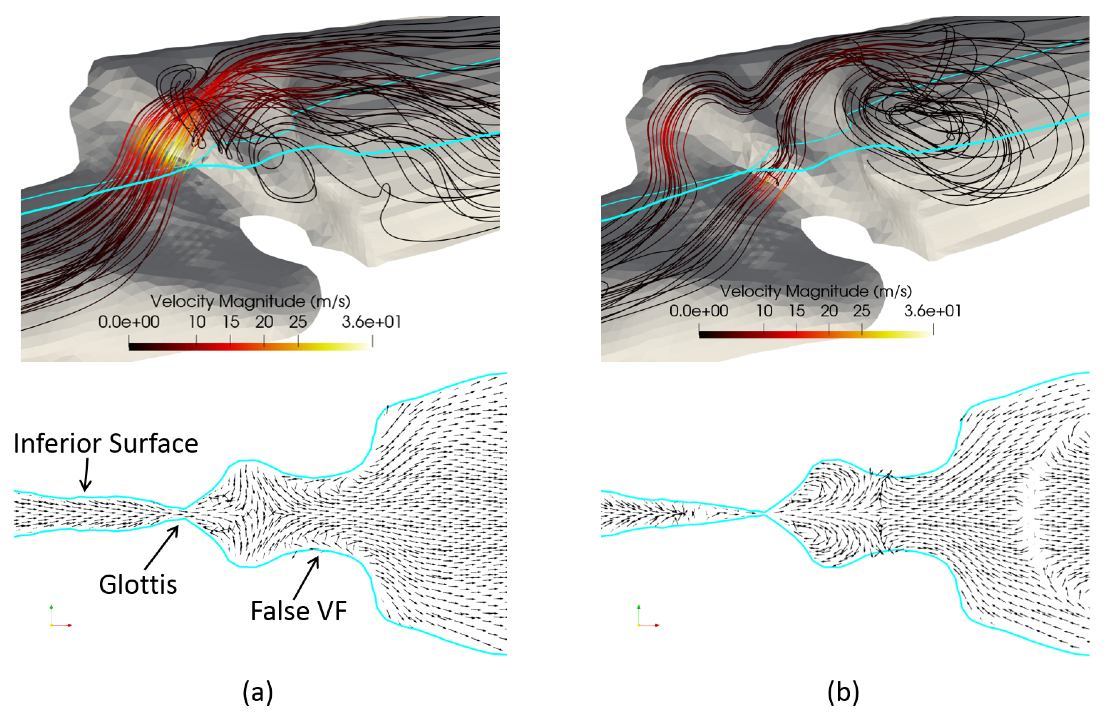 Fluids 07 00097 g011