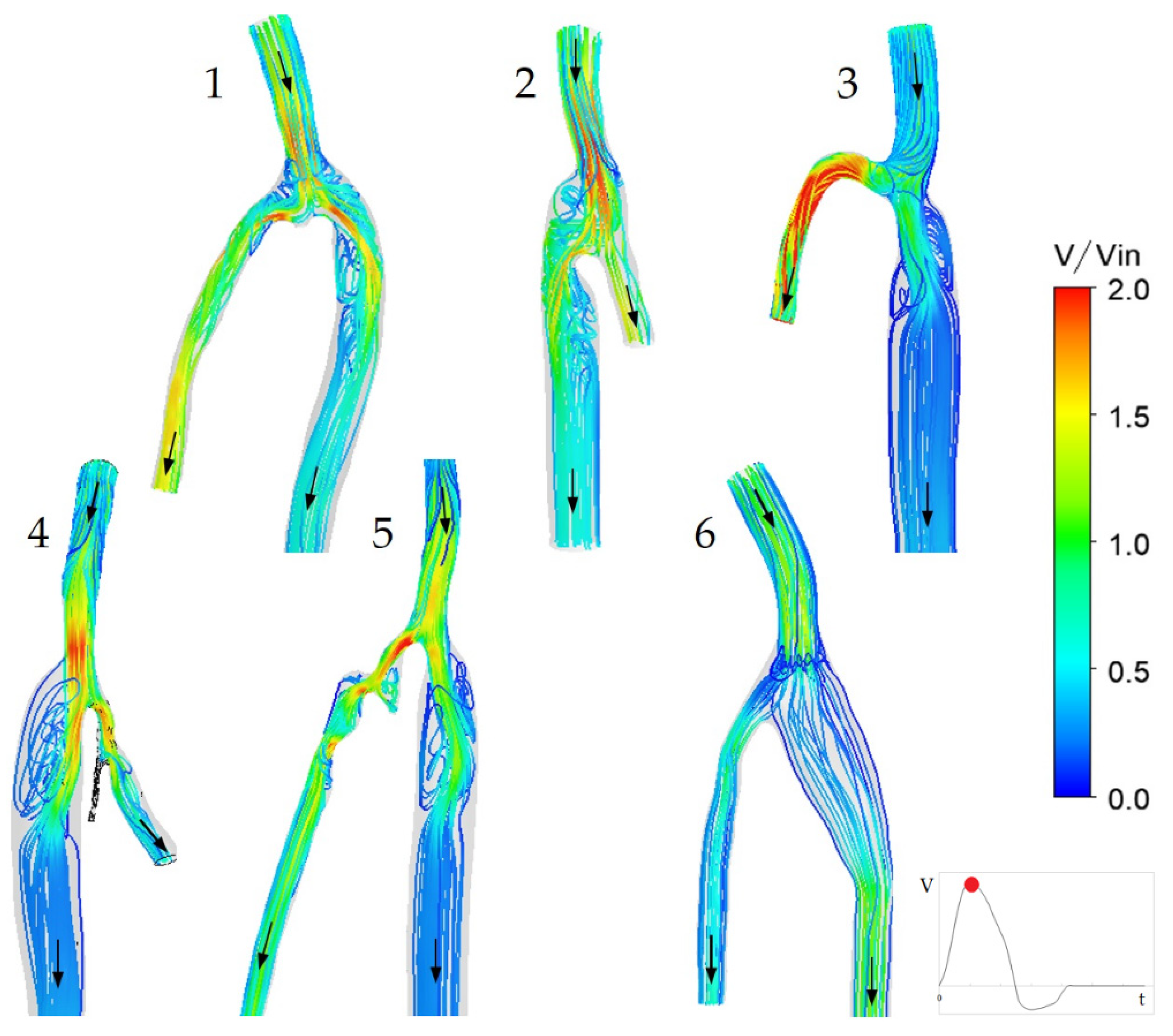 Fluids 07 00314 g007