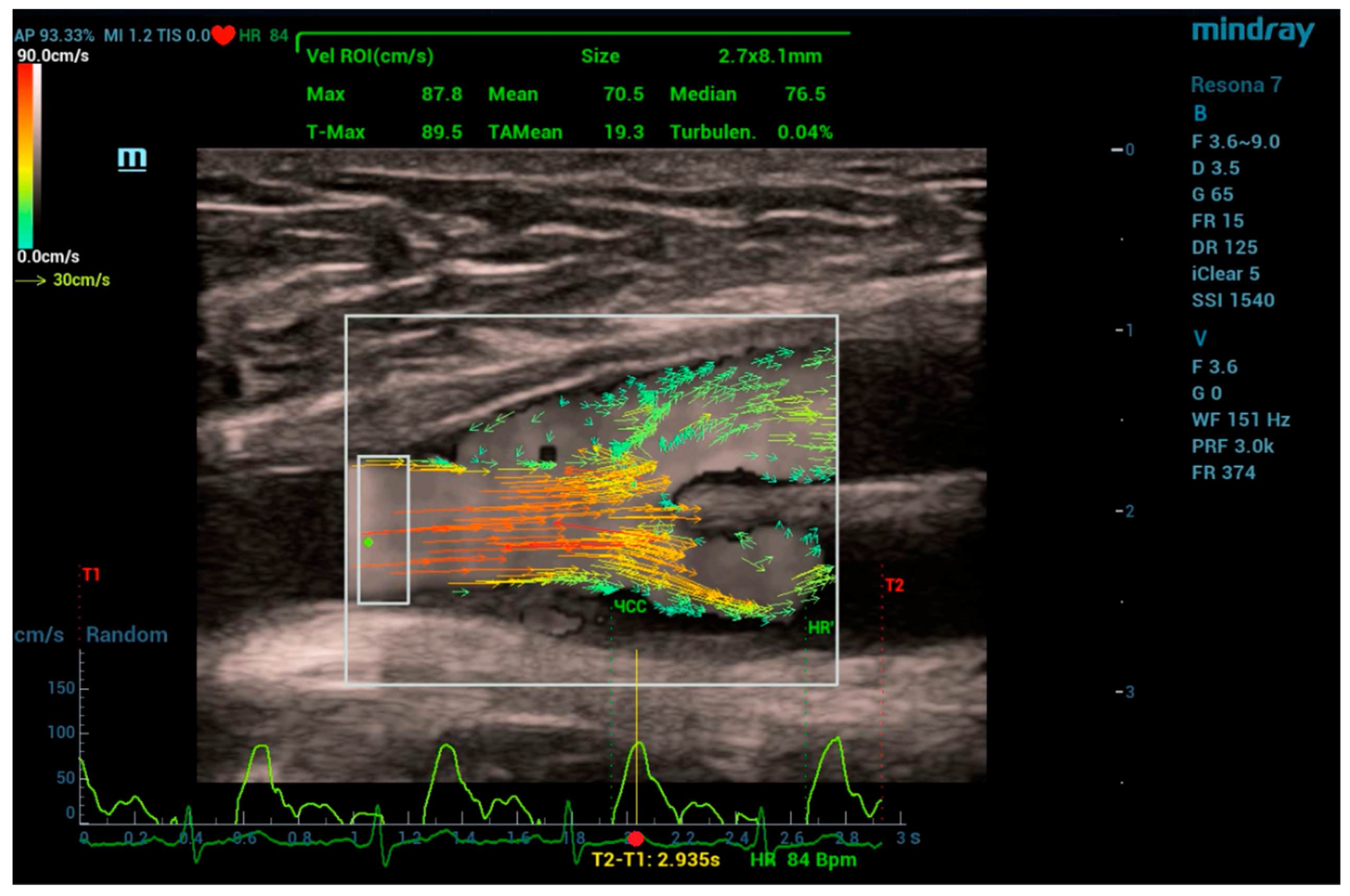 Fluids 09 00064 g004 Fluids 09 00064 g004
