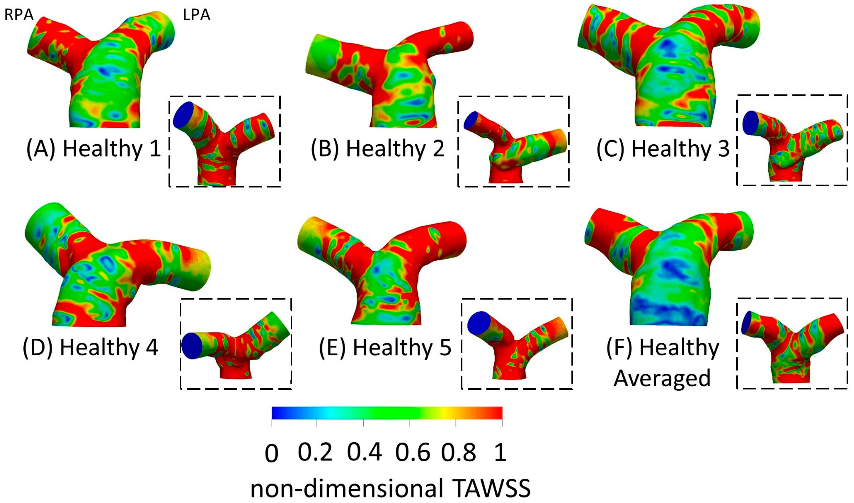 Fluids 09 00085 g005
