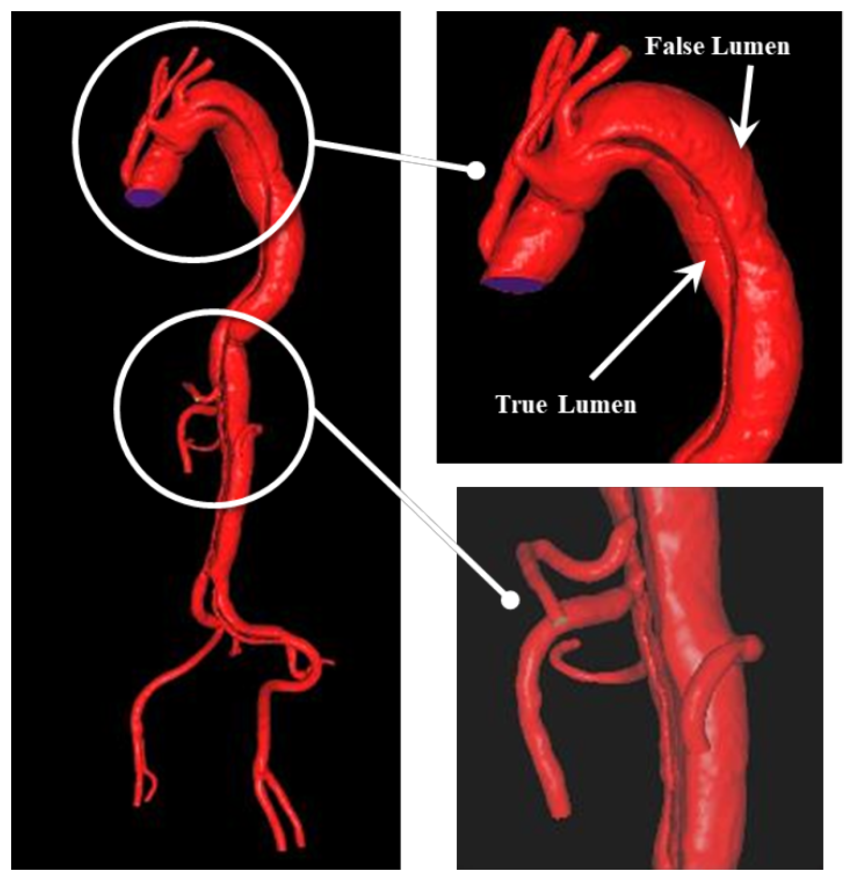 Fluids 09 00178 g004