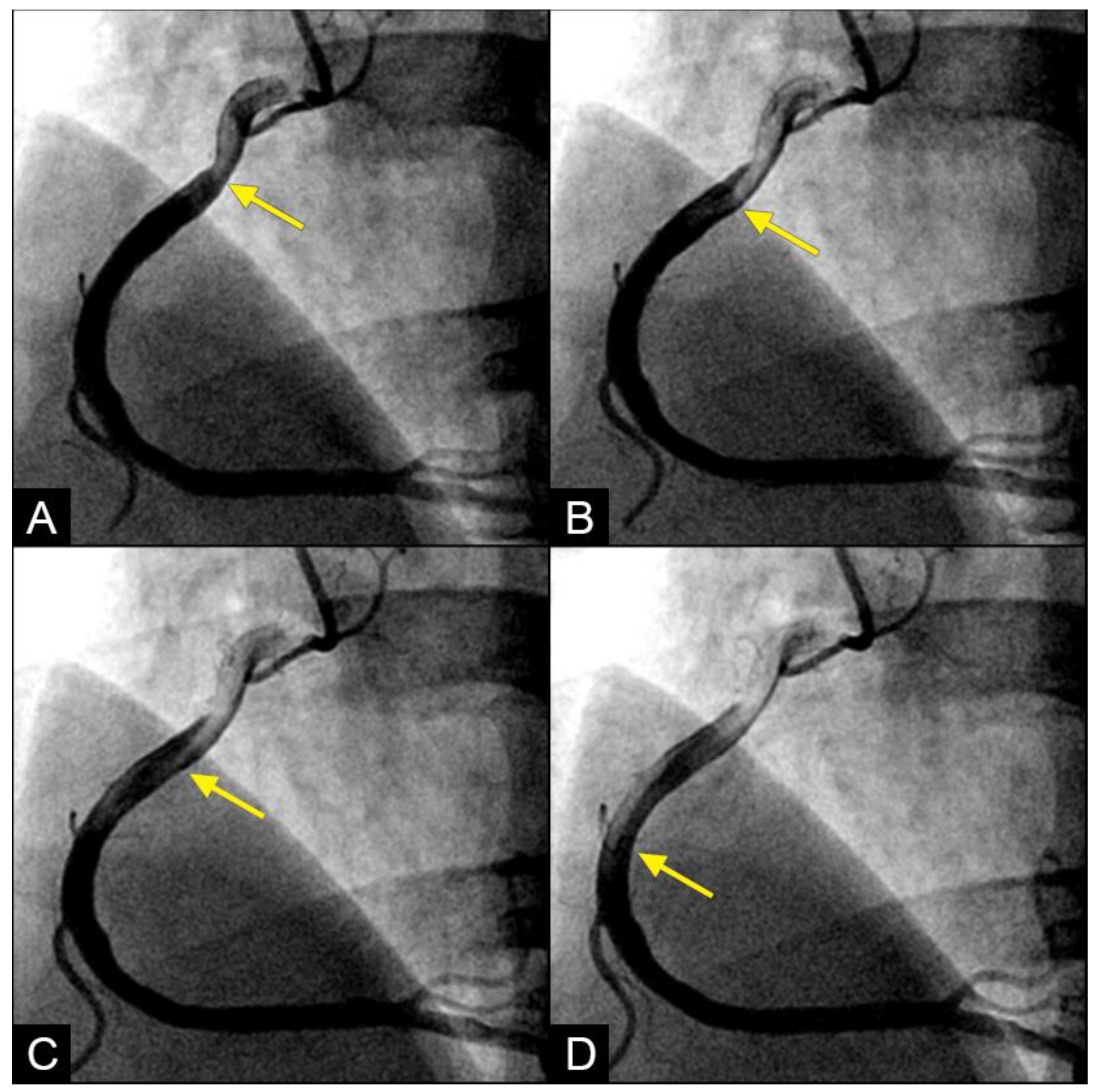 Fluids 09 00222 g005