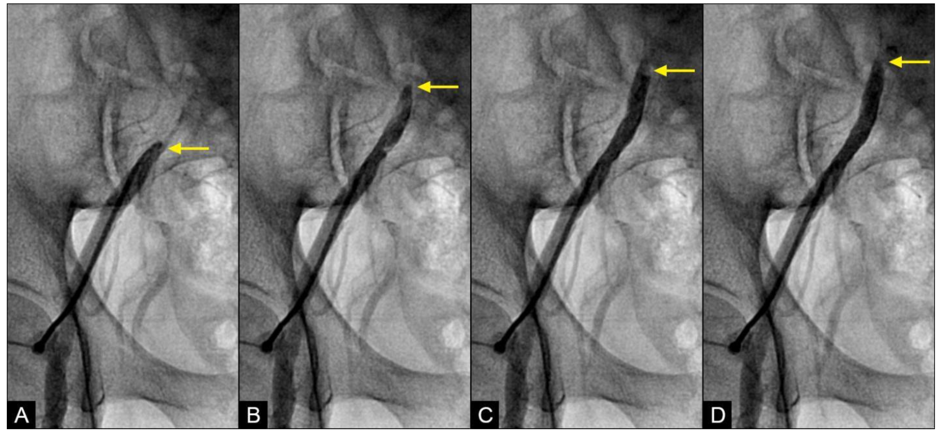 Fluids 09 00222 g006