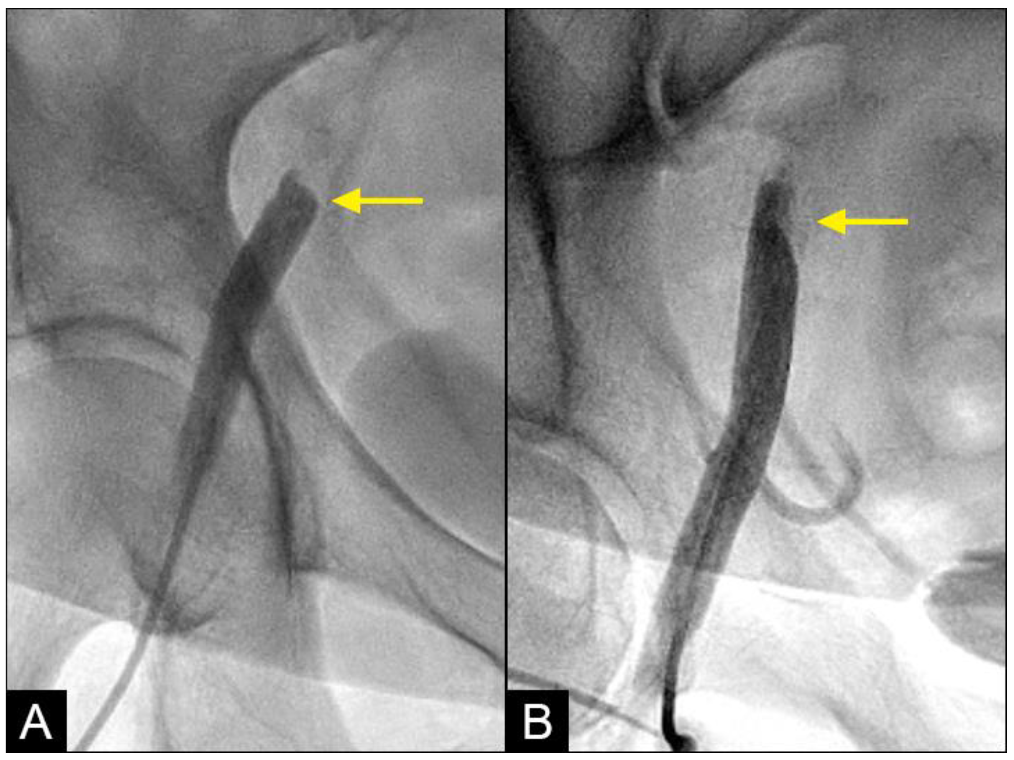 Fluids 09 00222 g007