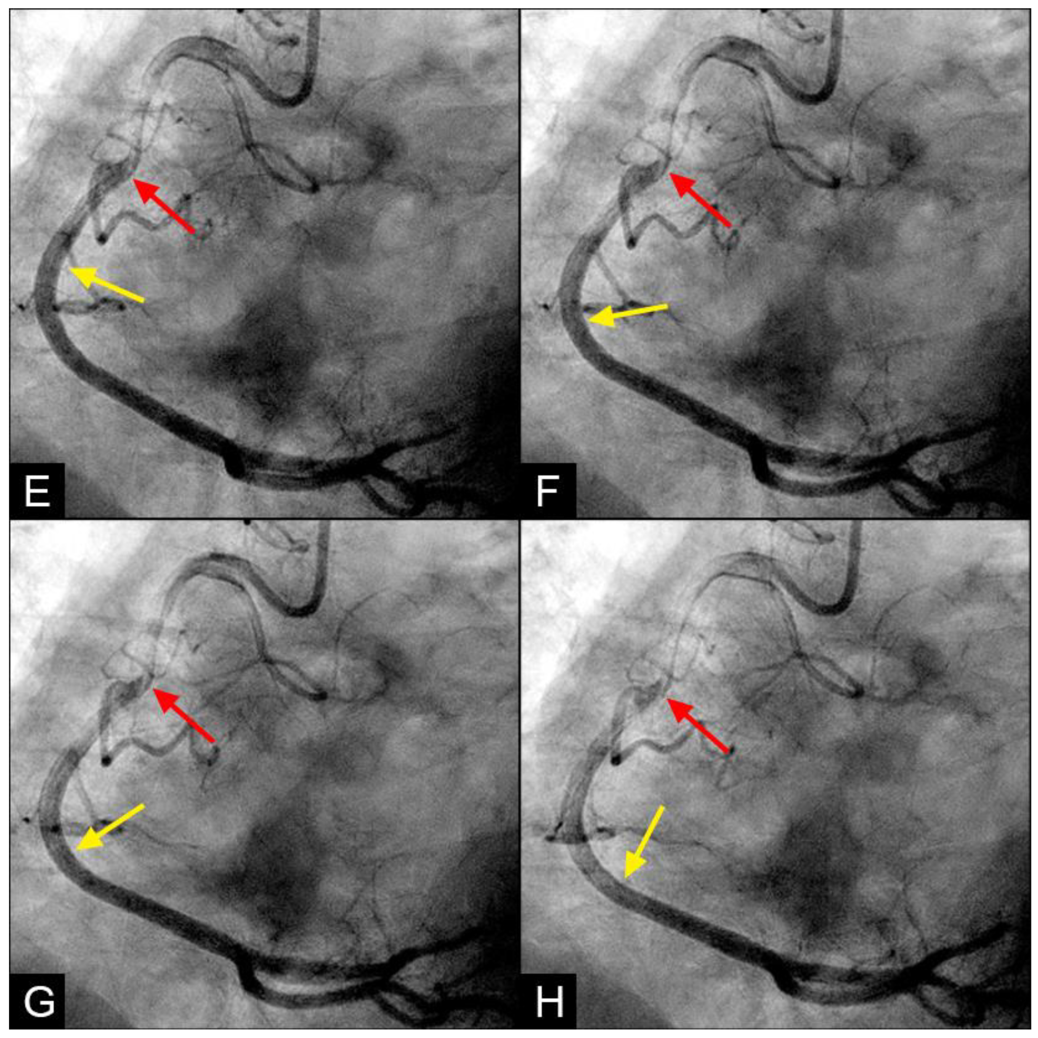 Fluids 09 00222 g009b