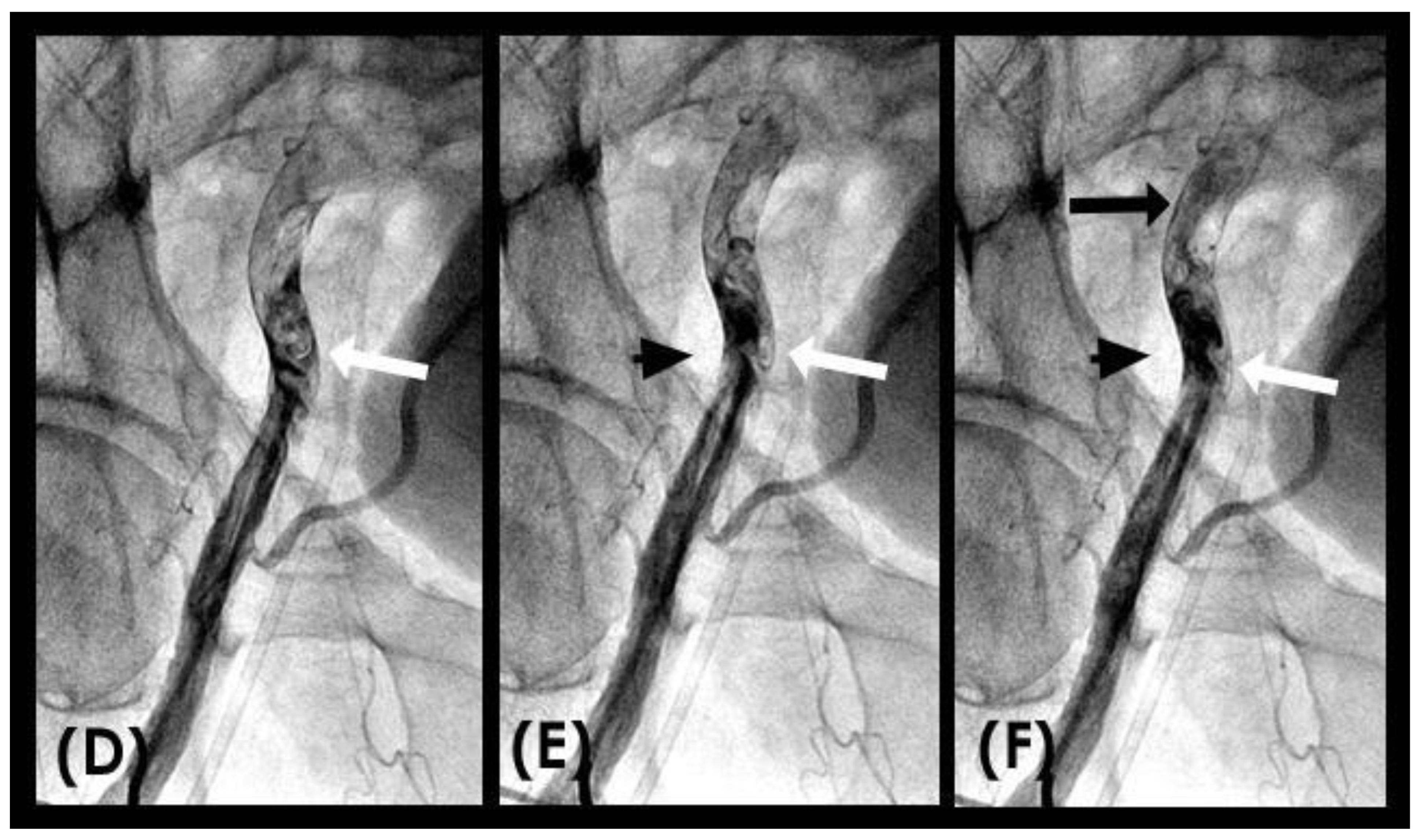 Fluids 09 00222 g010b