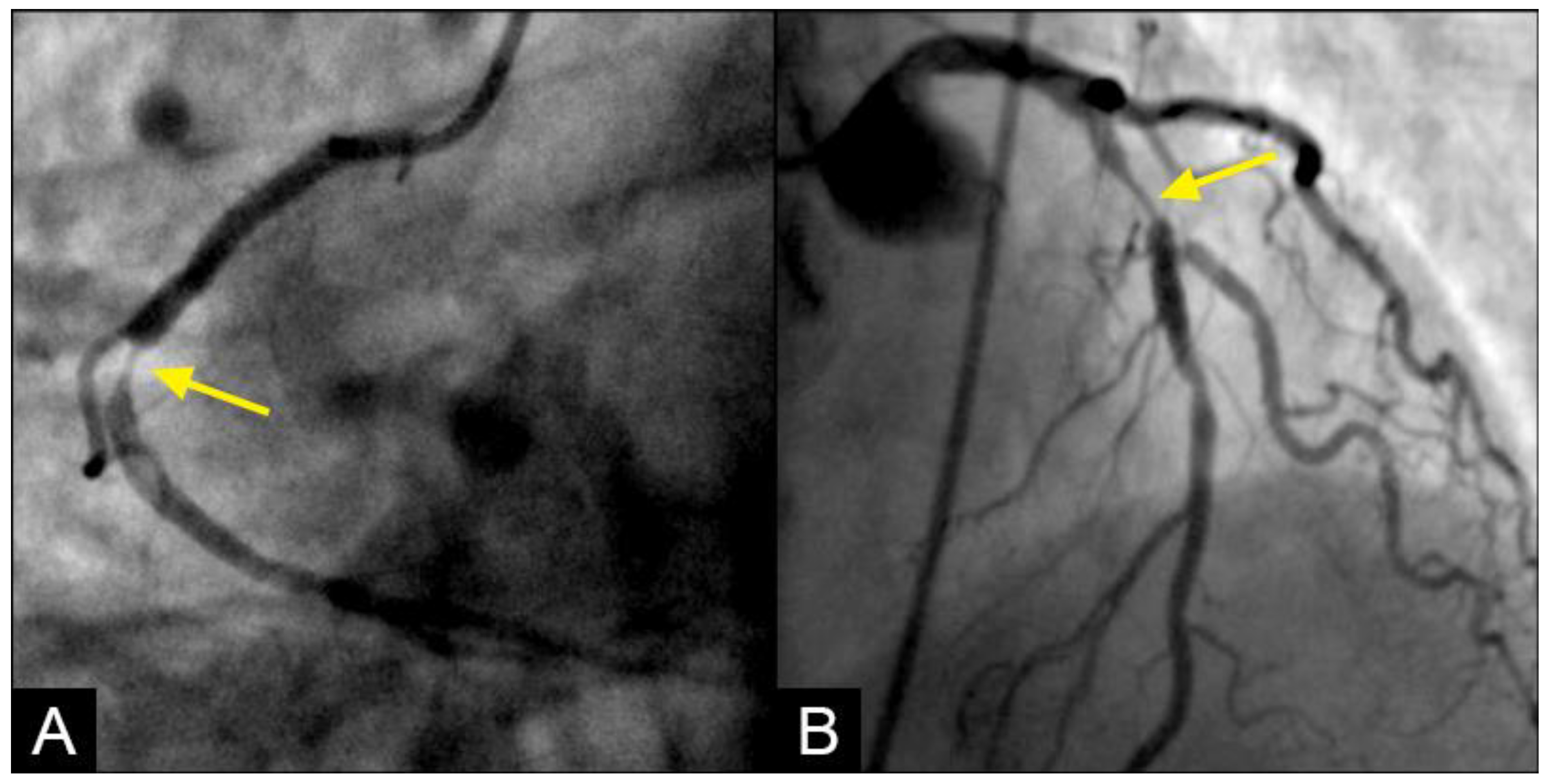 Fluids 09 00222 g011