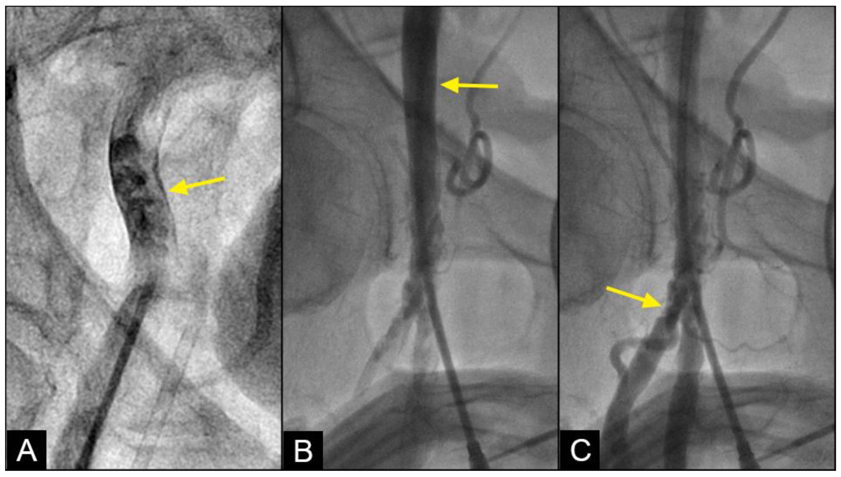 Fluids 09 00222 g013