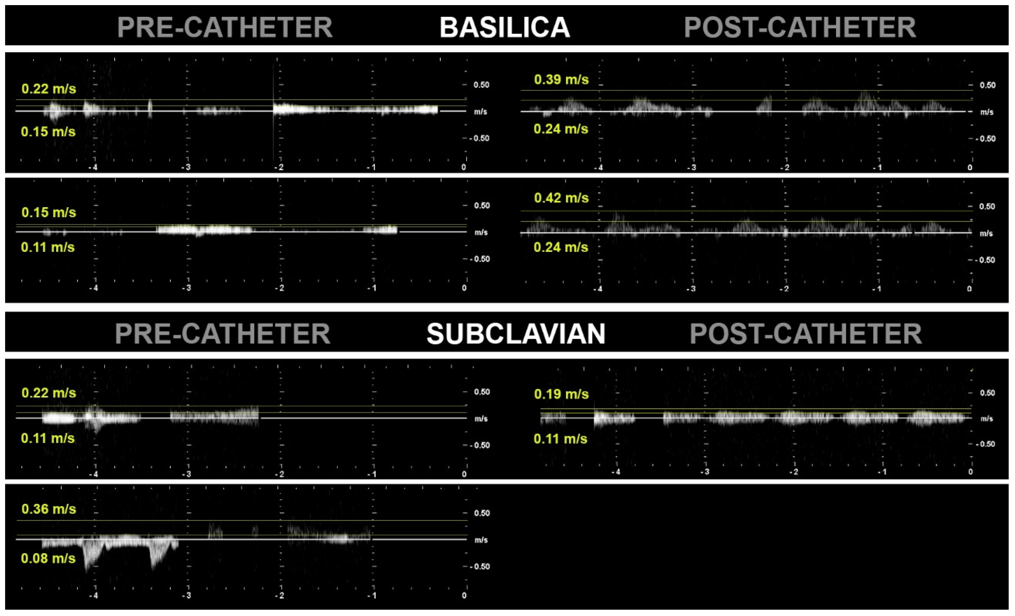 Fluids 09 00245 g011