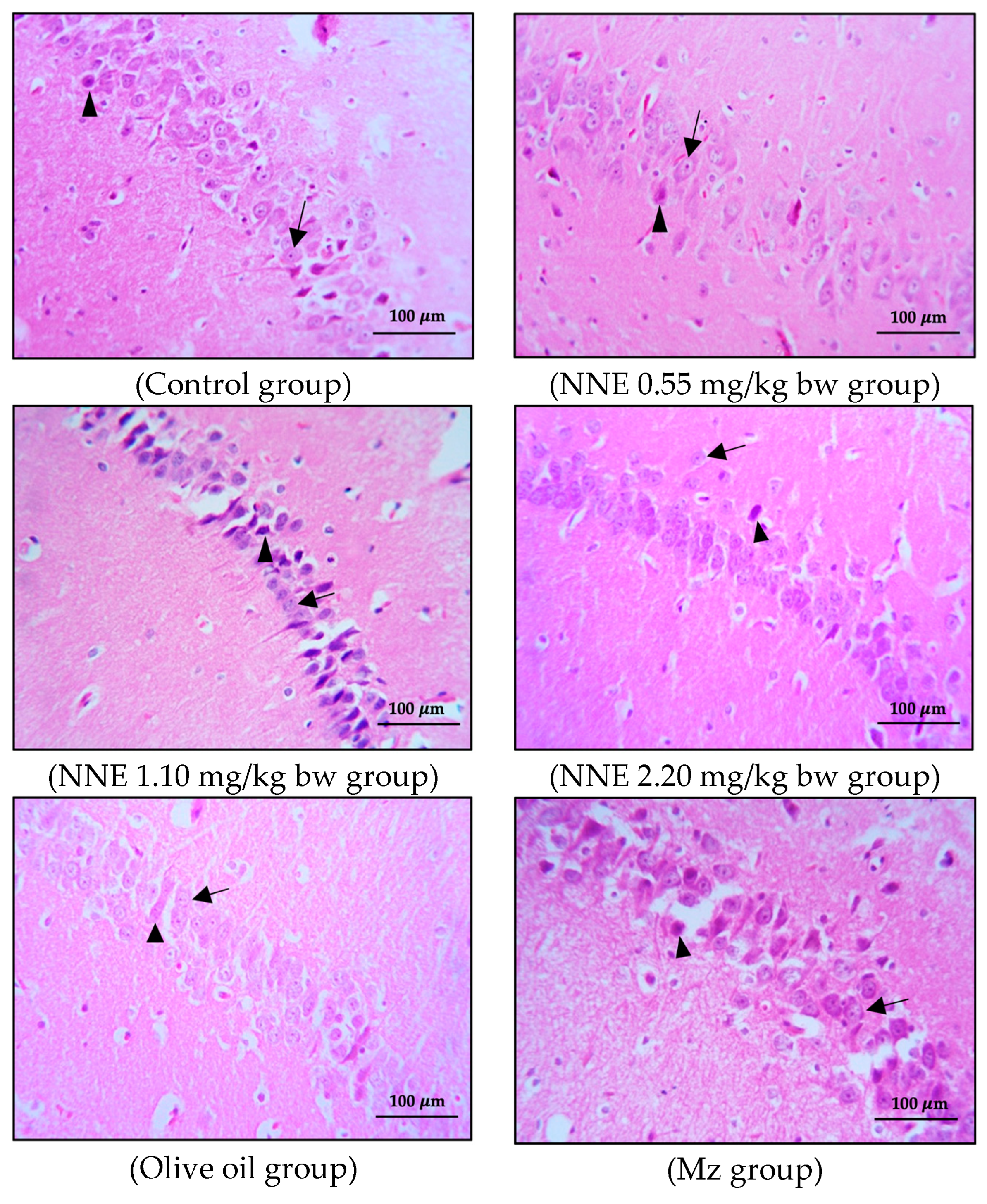 Foods 12 02175 g005a Foods 12 02175 g005a