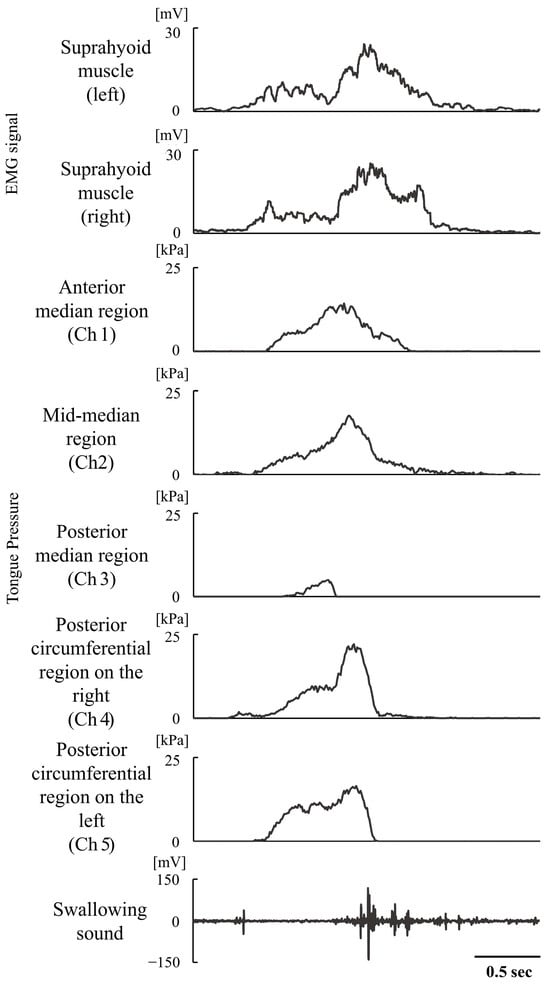 Muscle activity, tongue pressure, and swallowing sound.