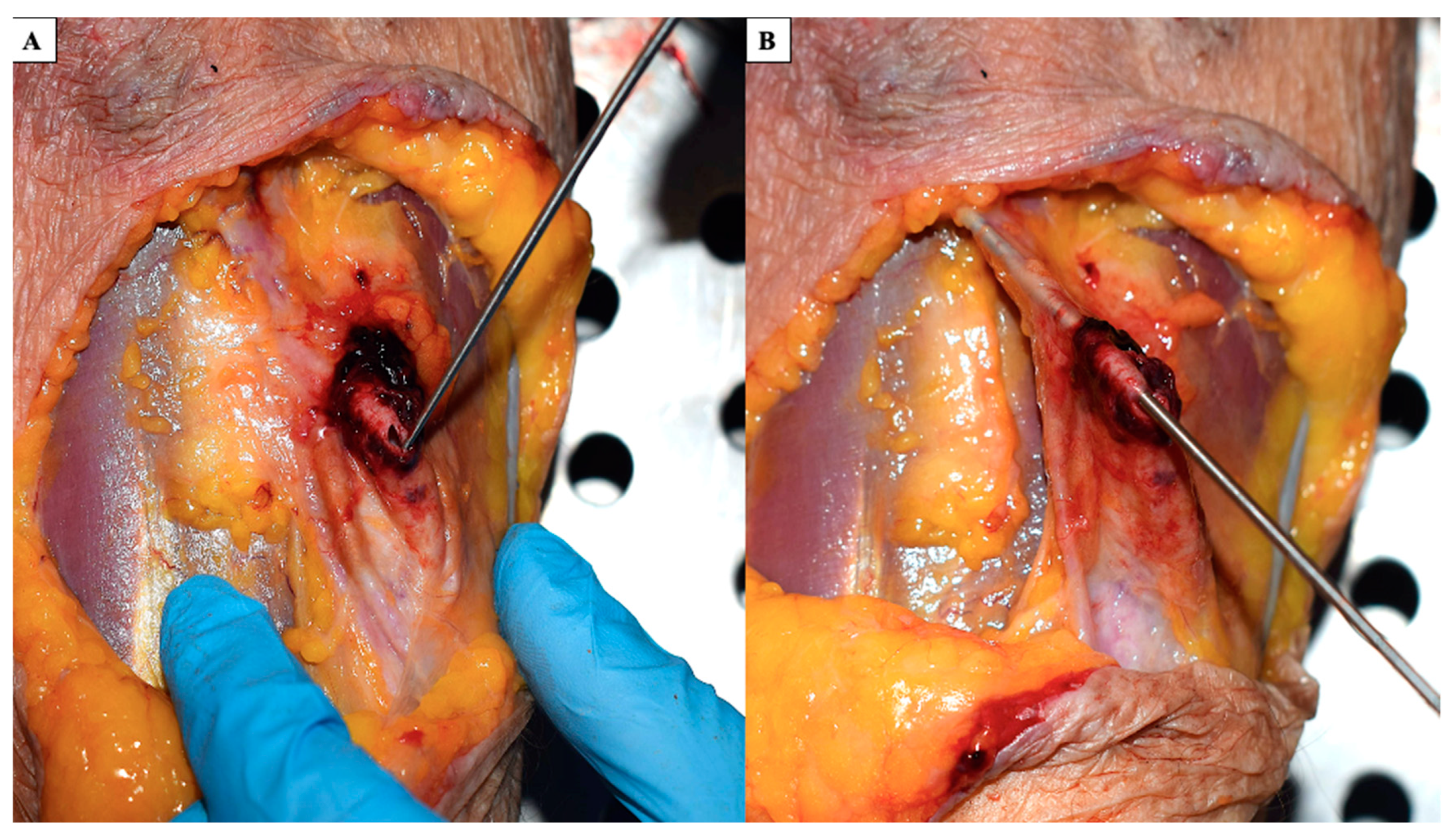 Forensicsci 02 00045 g002