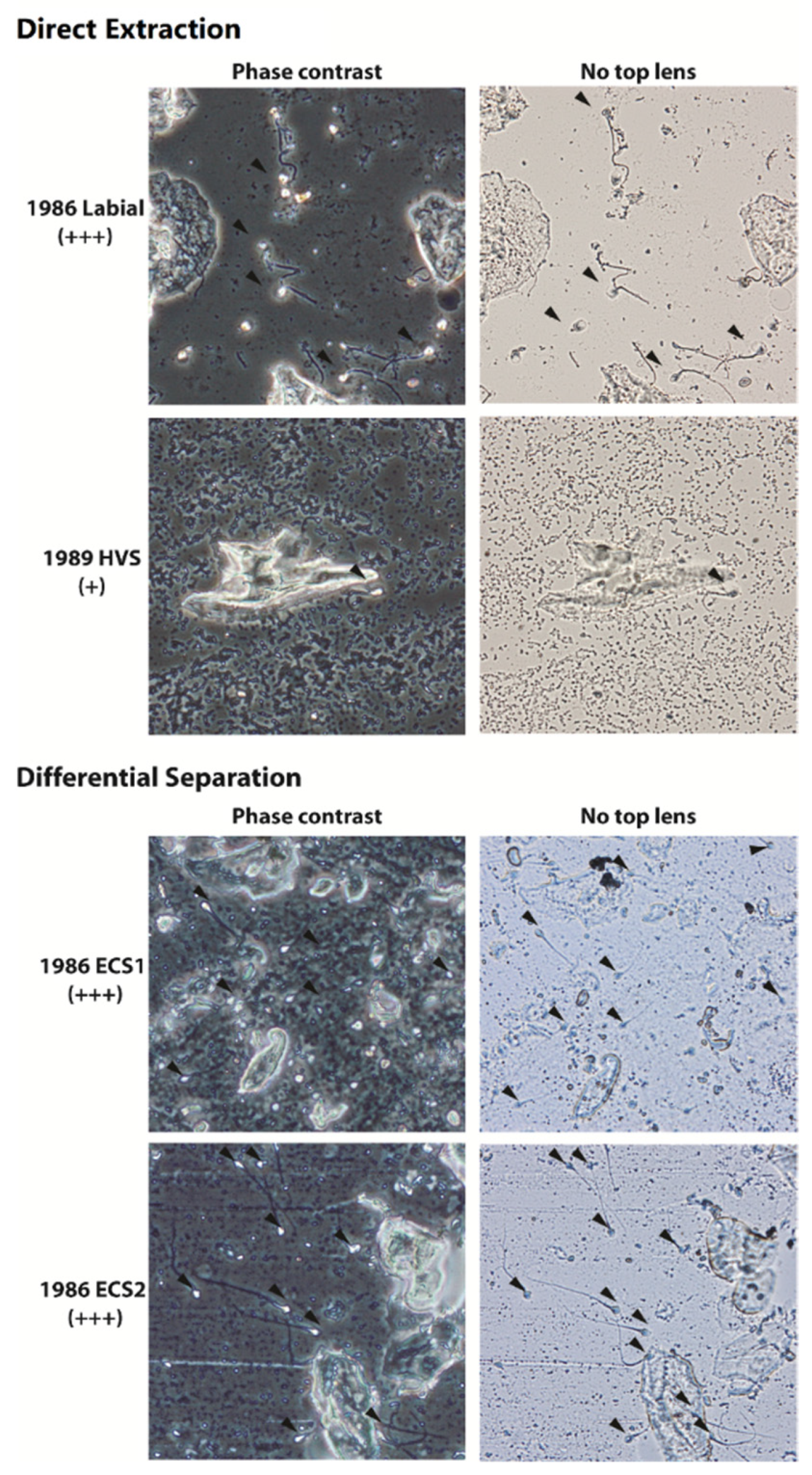 Forensicsci 02 00057 g005