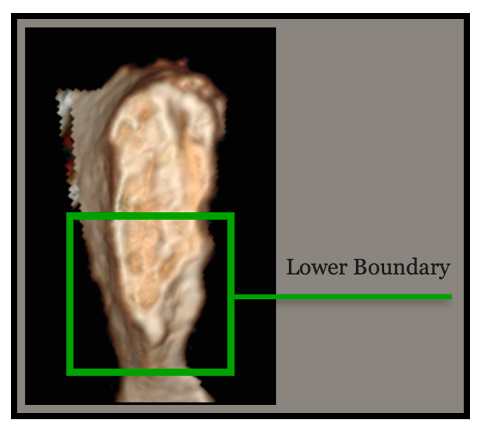 Forensicsci 03 00009 g004 Forensicsci 03 00009 g004