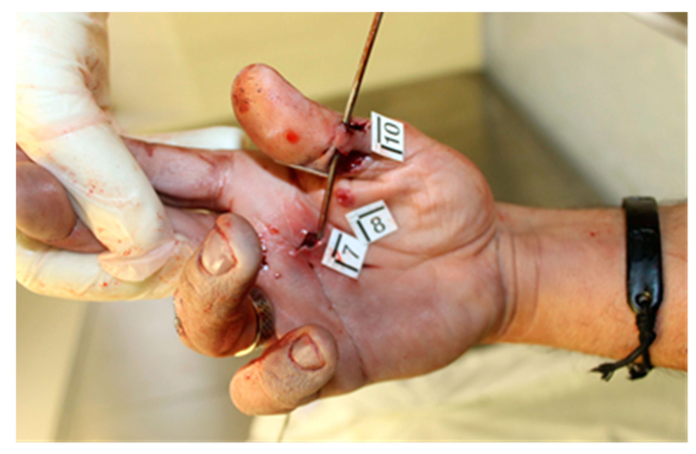 Forensicsci 04 00040 g003