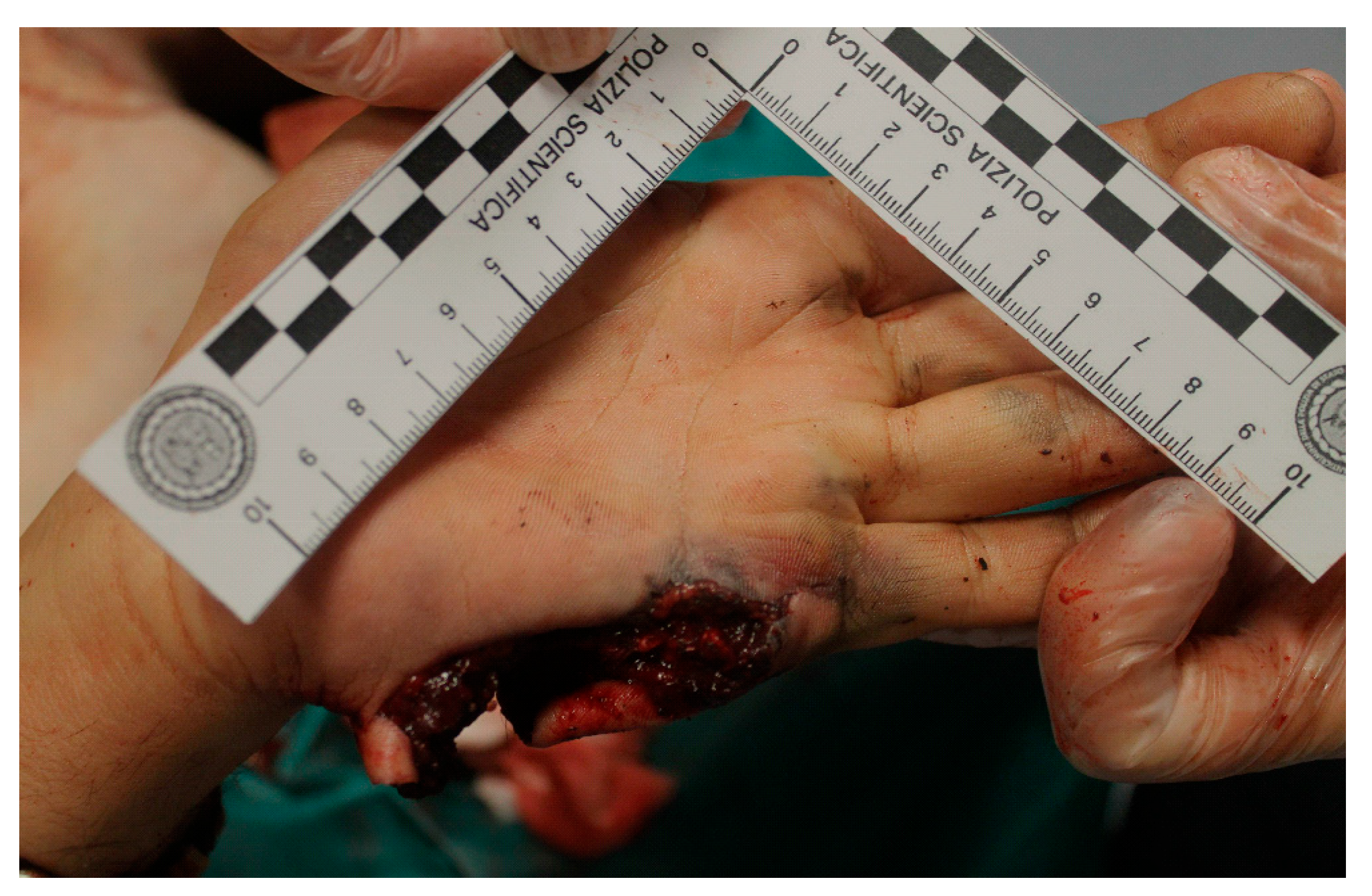 Forensicsci 04 00040 g007