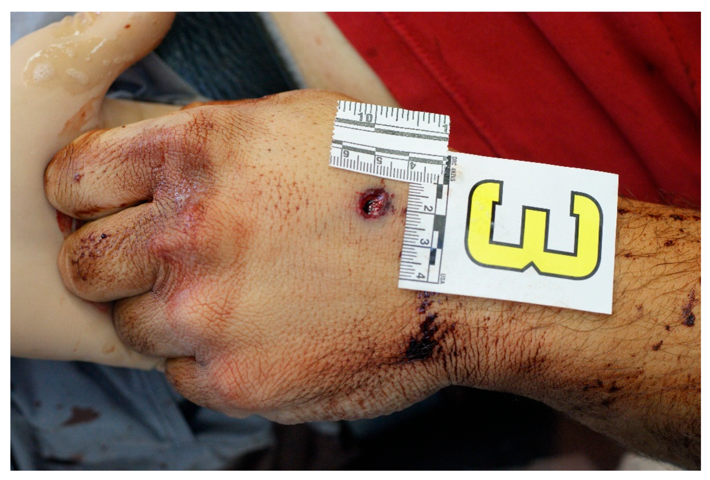 Forensicsci 04 00040 g008