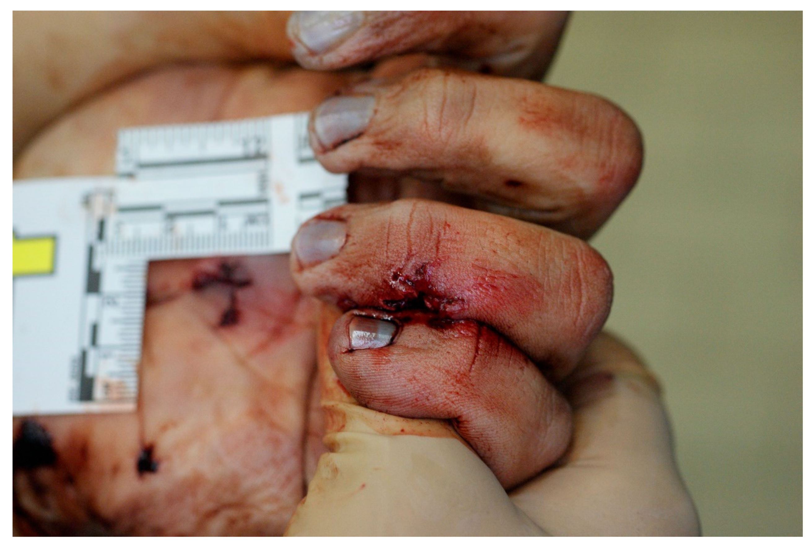 Forensicsci 04 00040 g010