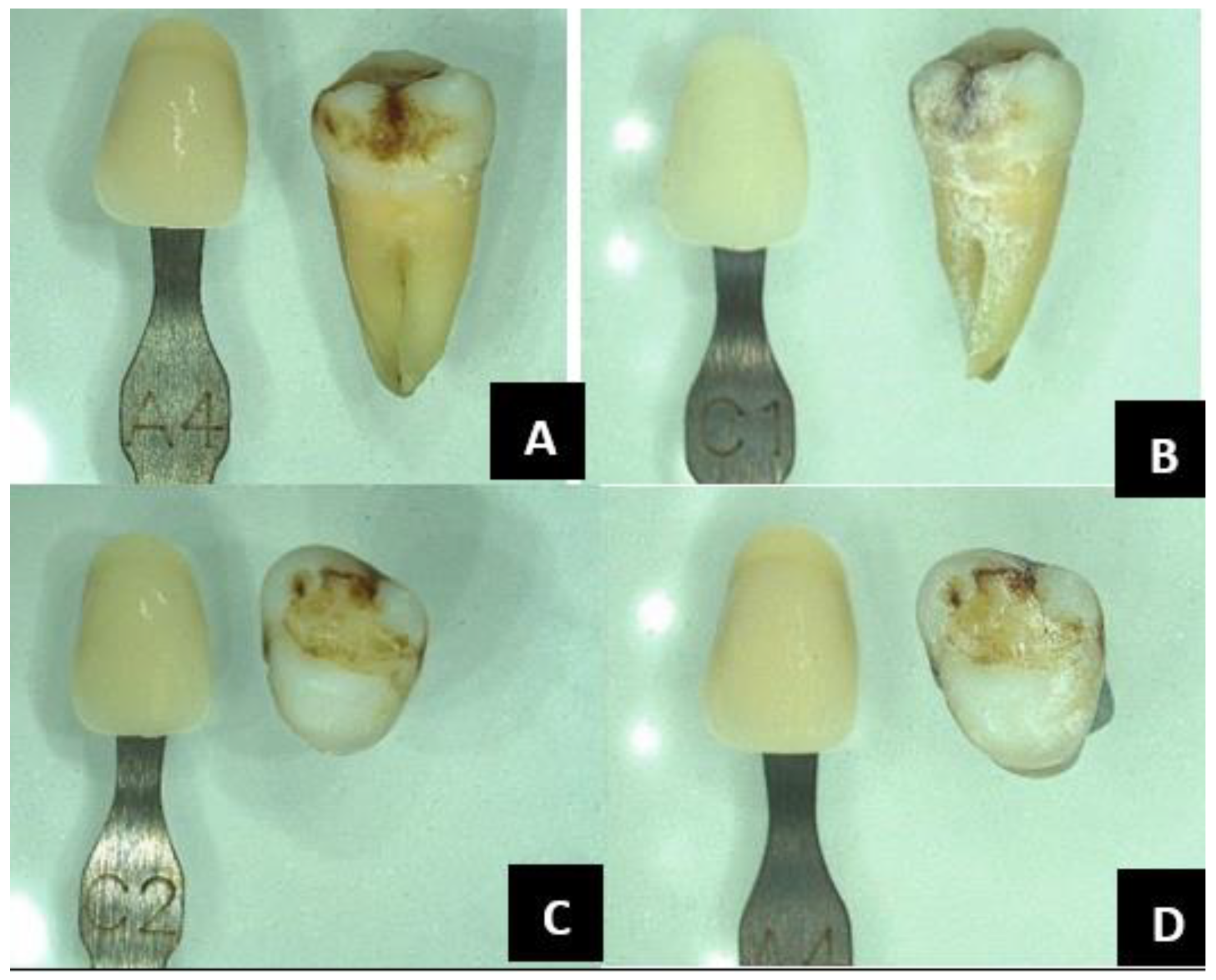 Forensicsci 05 00012 g004