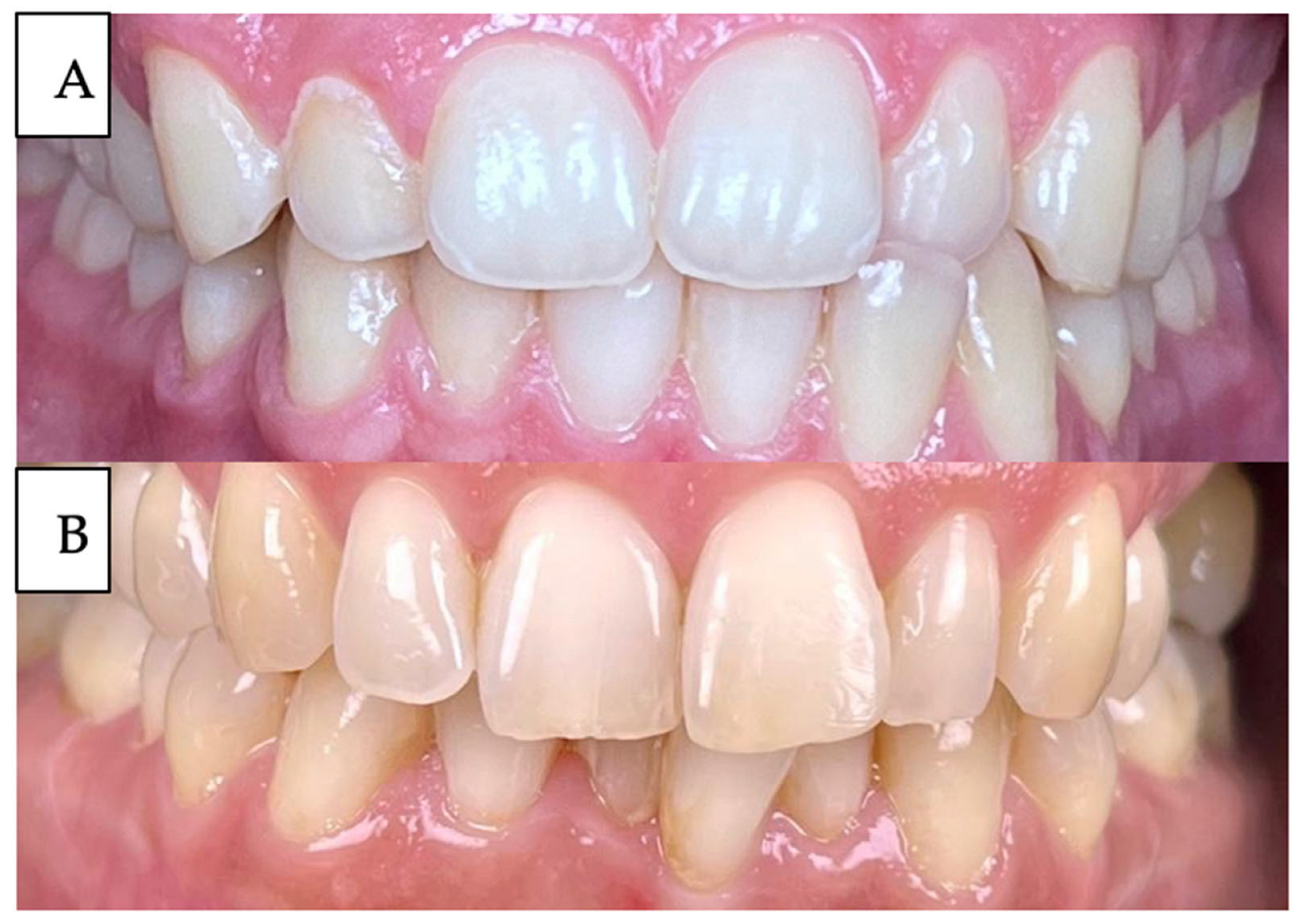 Forensicsci 05 00077 g001