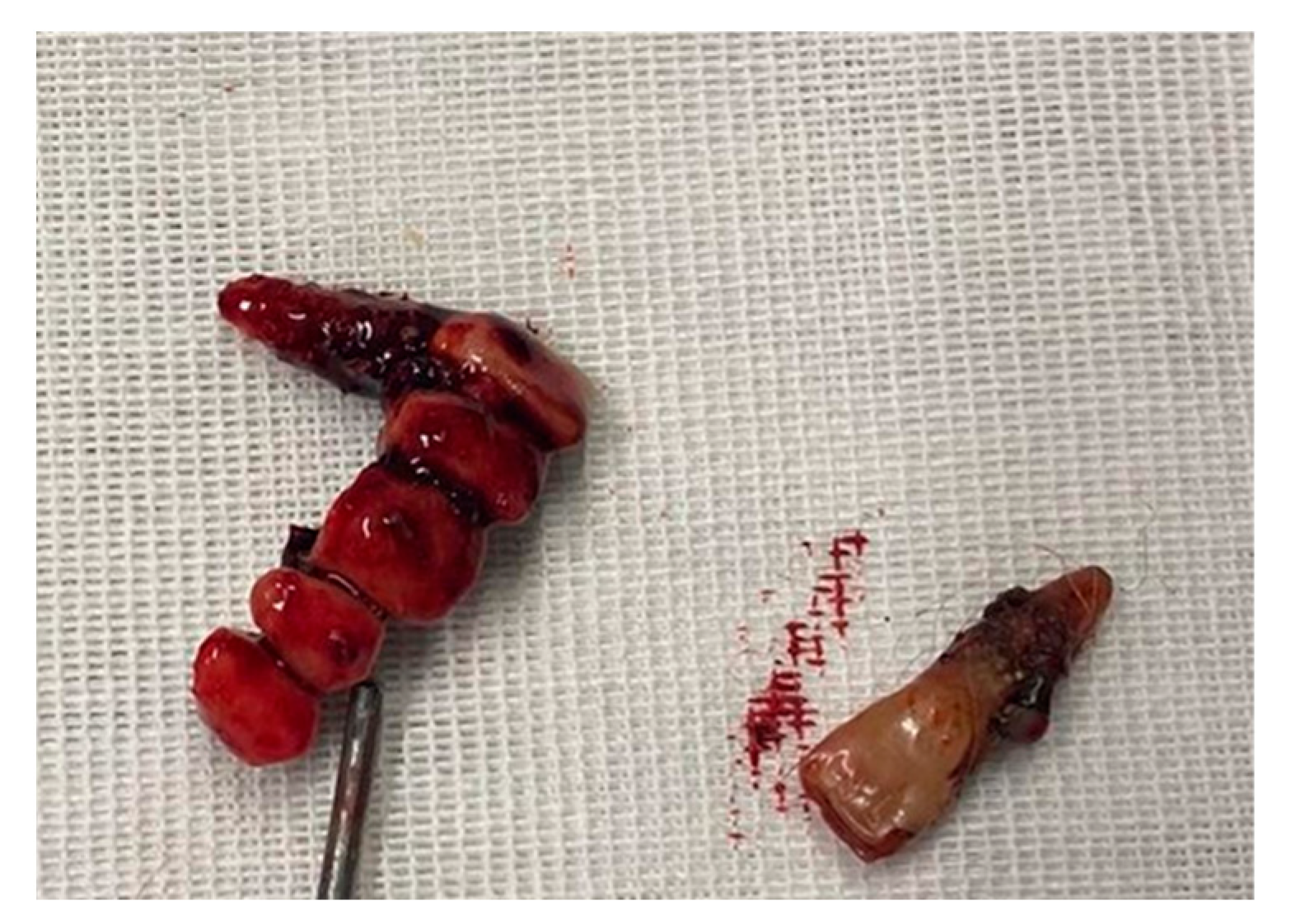Forensicsci 06 00015 g005 Forensicsci 06 00015 g005