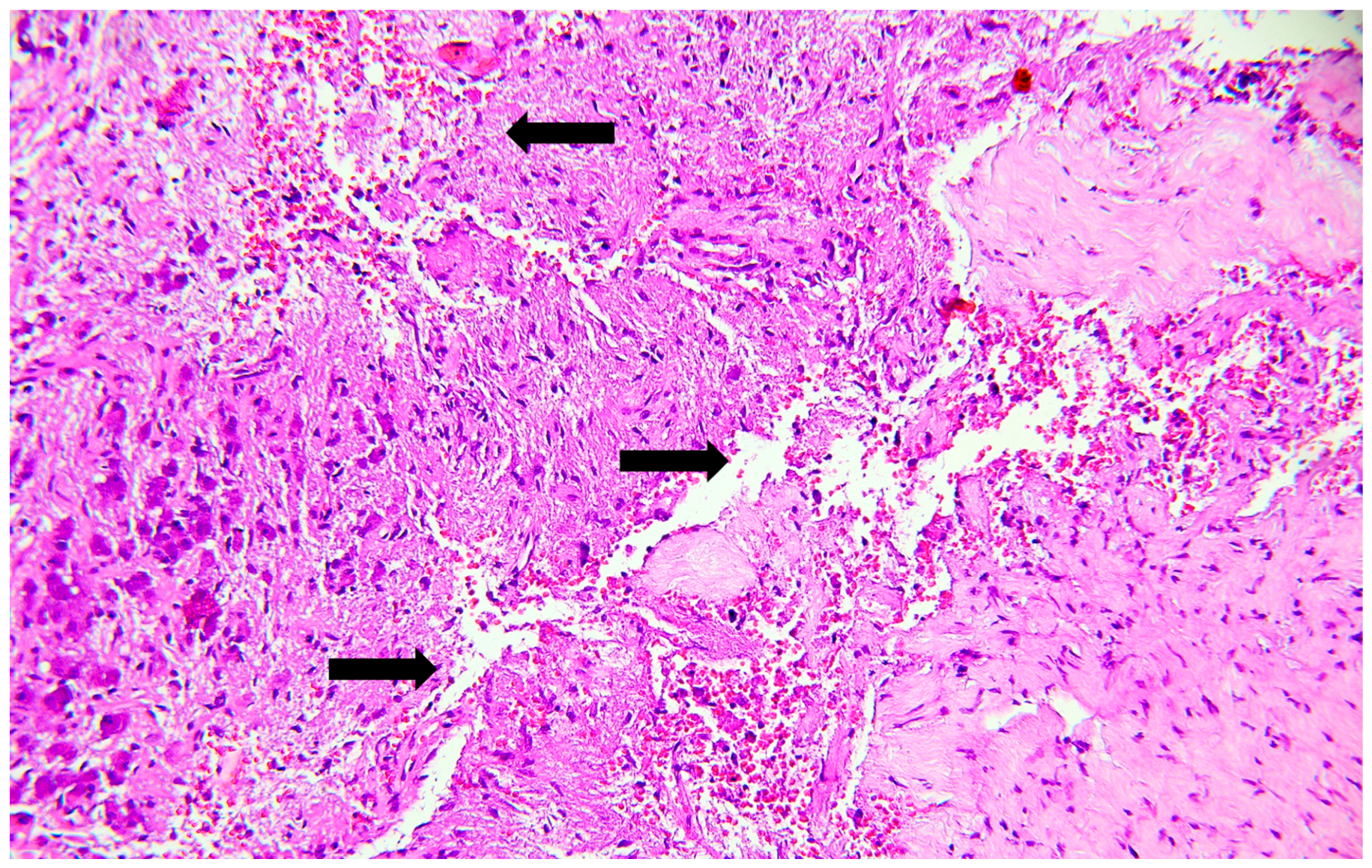 Forensicsci 06 00087 g002