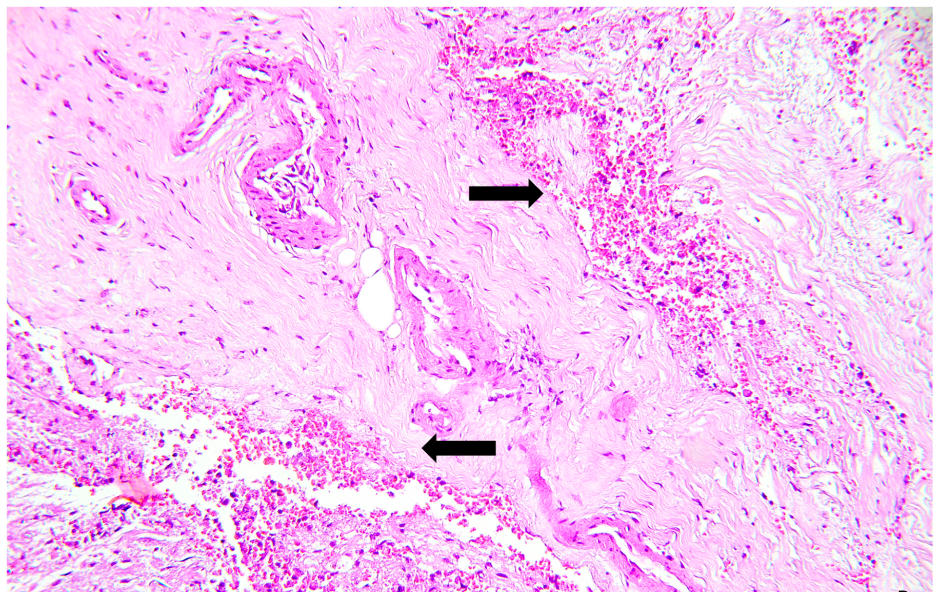 Forensicsci 06 00087 g003