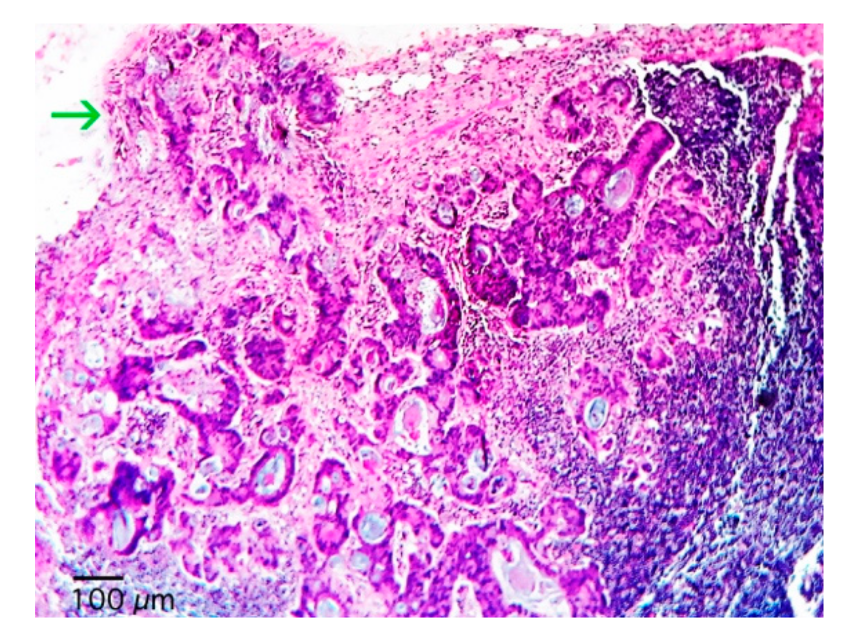 Gastroent 11 00004 g001