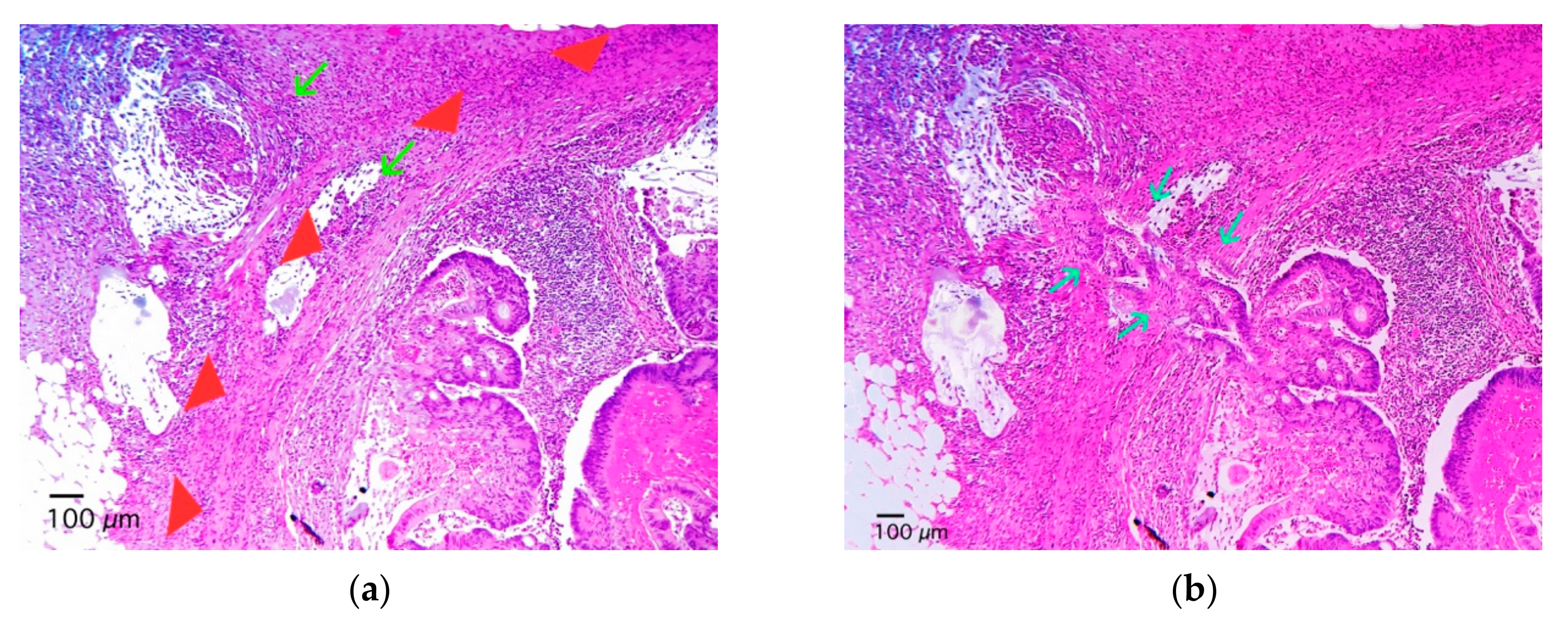 Gastroent 11 00004 g002