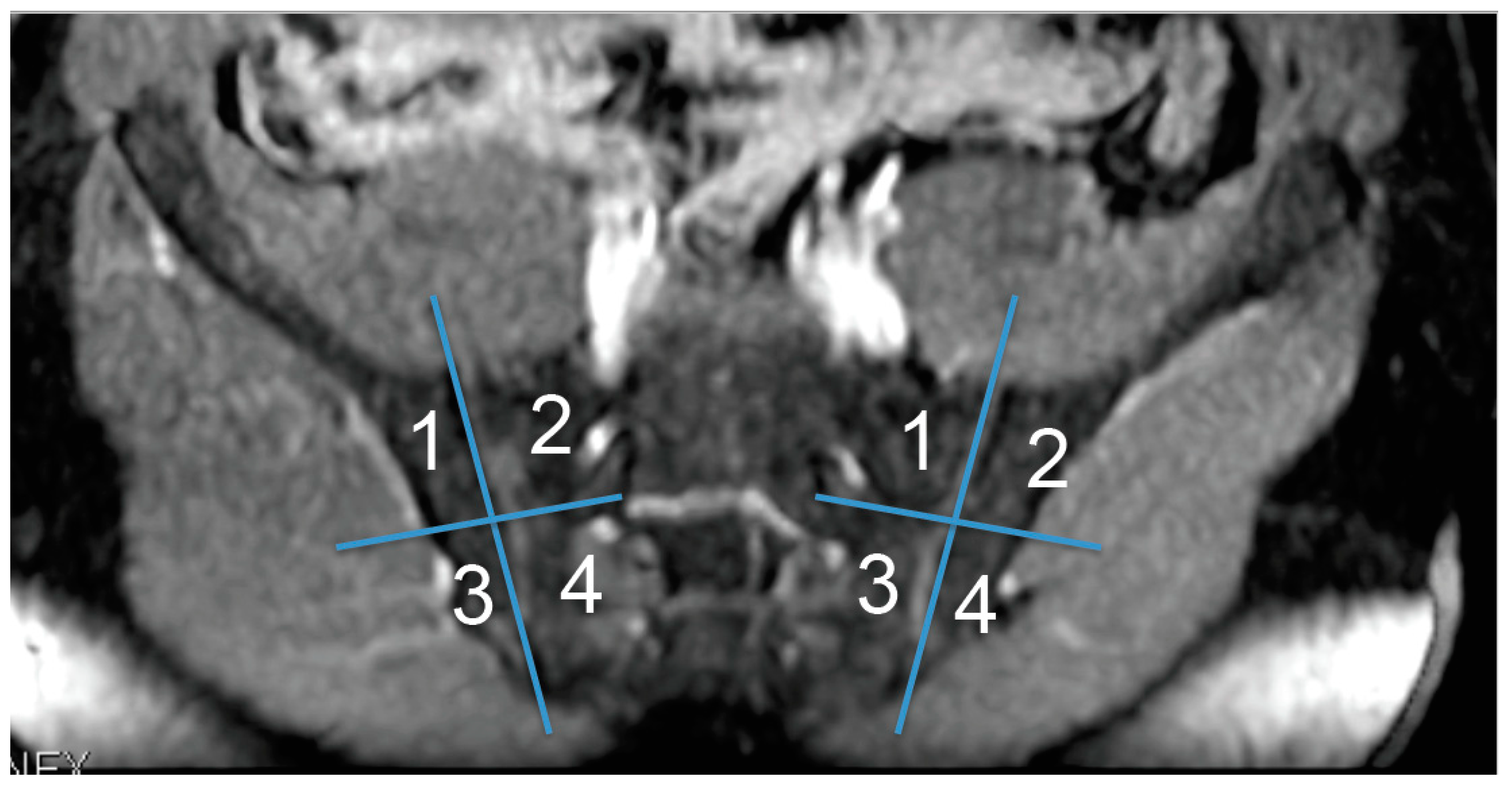 Gastroent 11 00008 g001