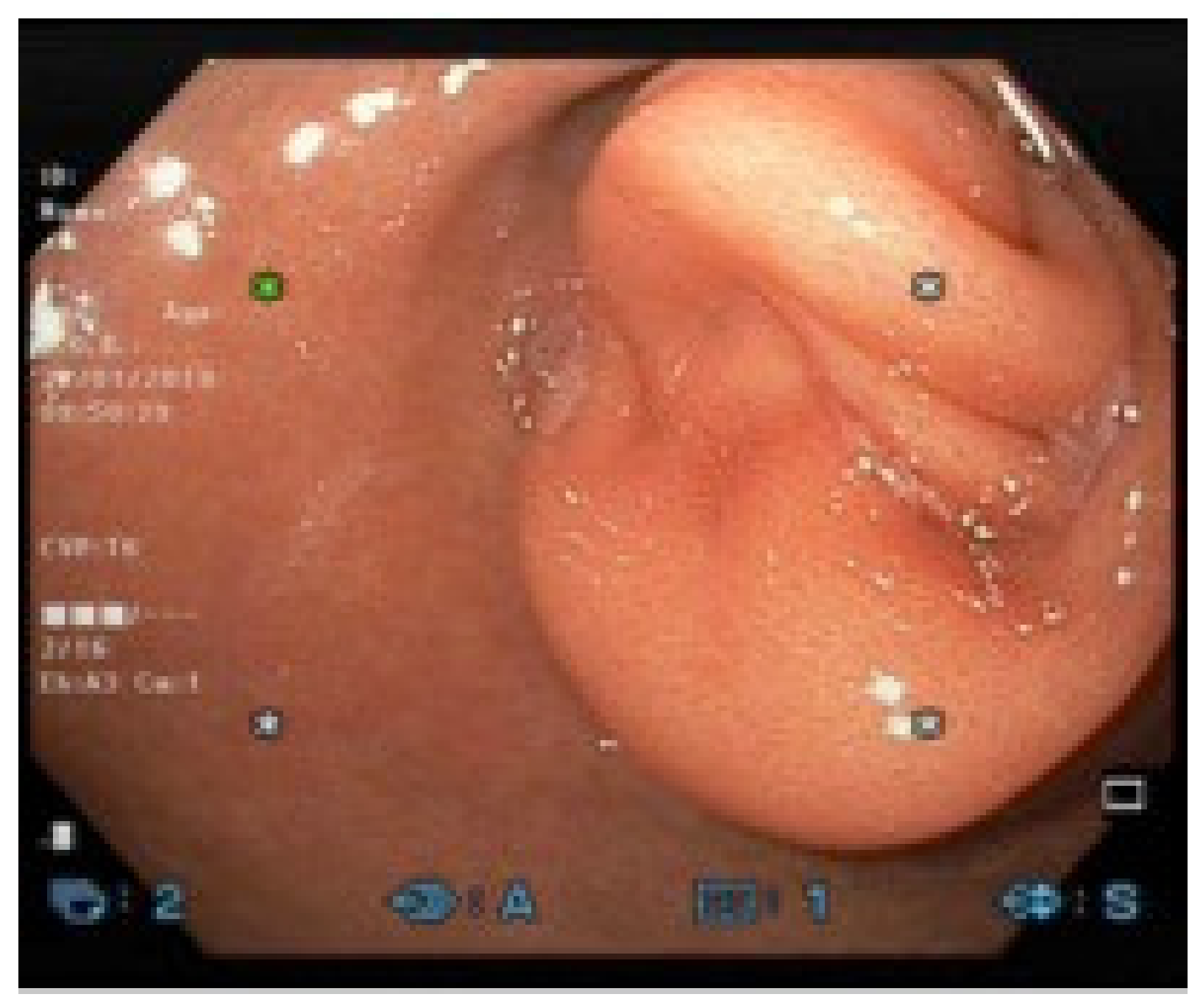 Gastroent 12 00002 g001