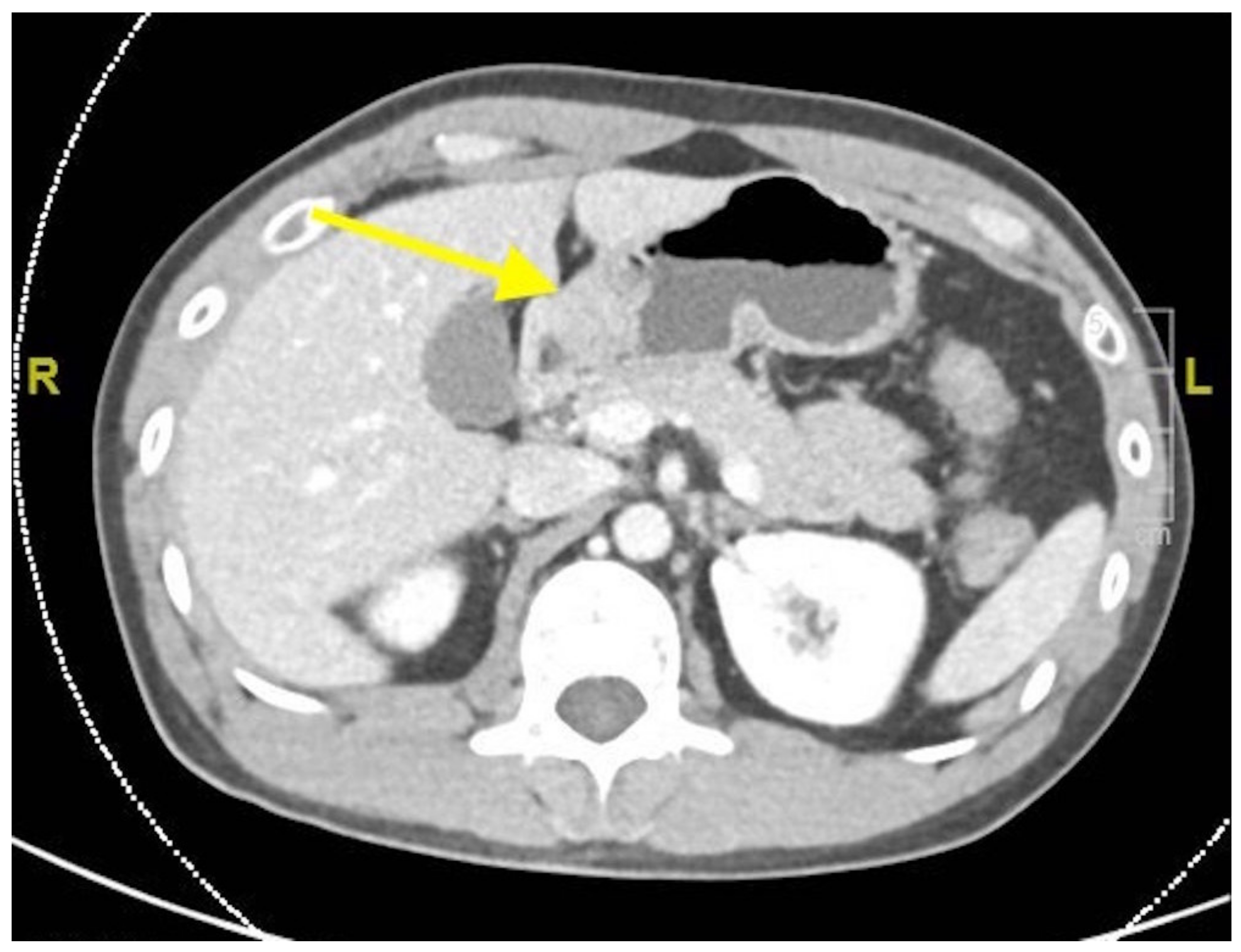 Gastroent 12 00002 g002