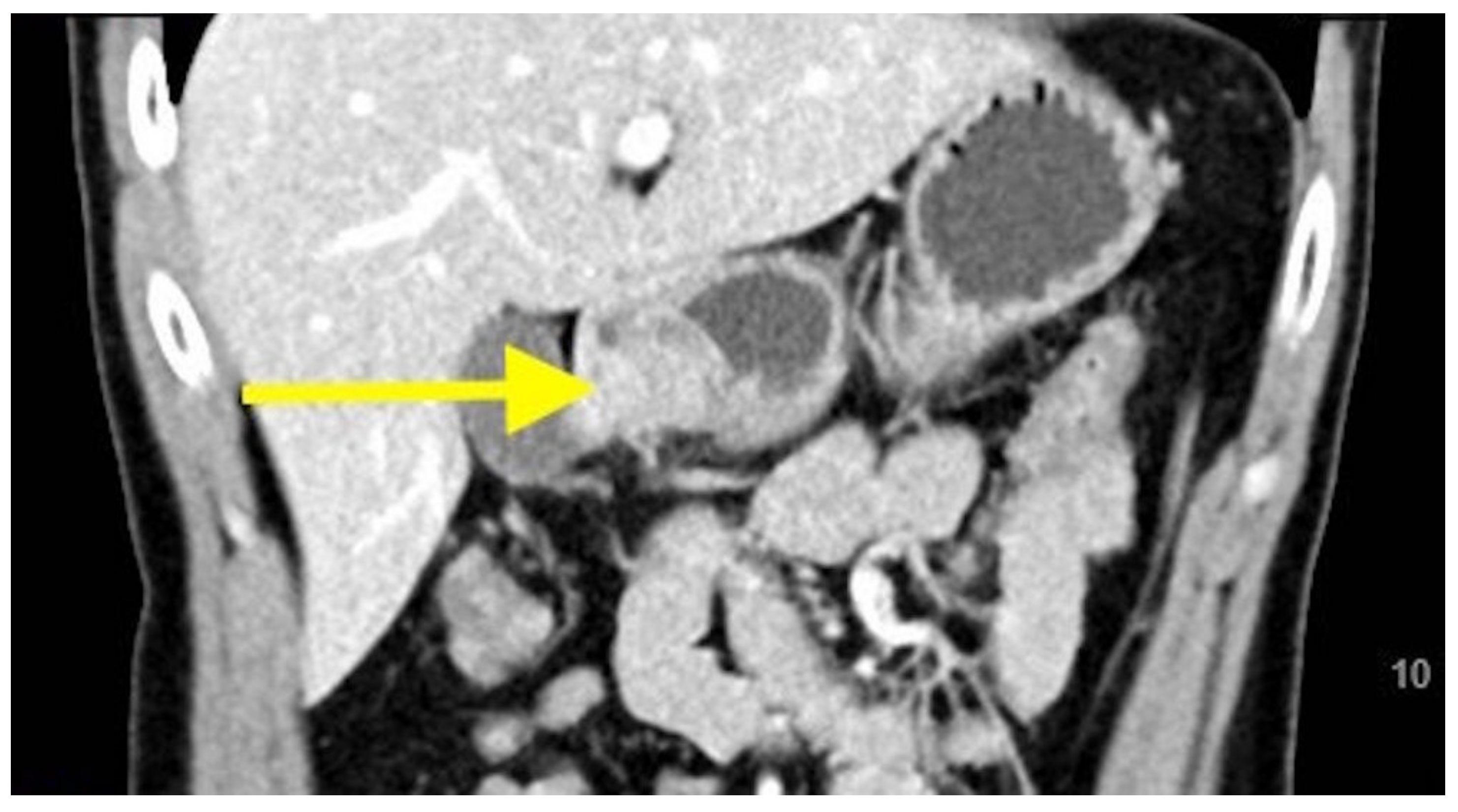 Gastroent 12 00002 g003