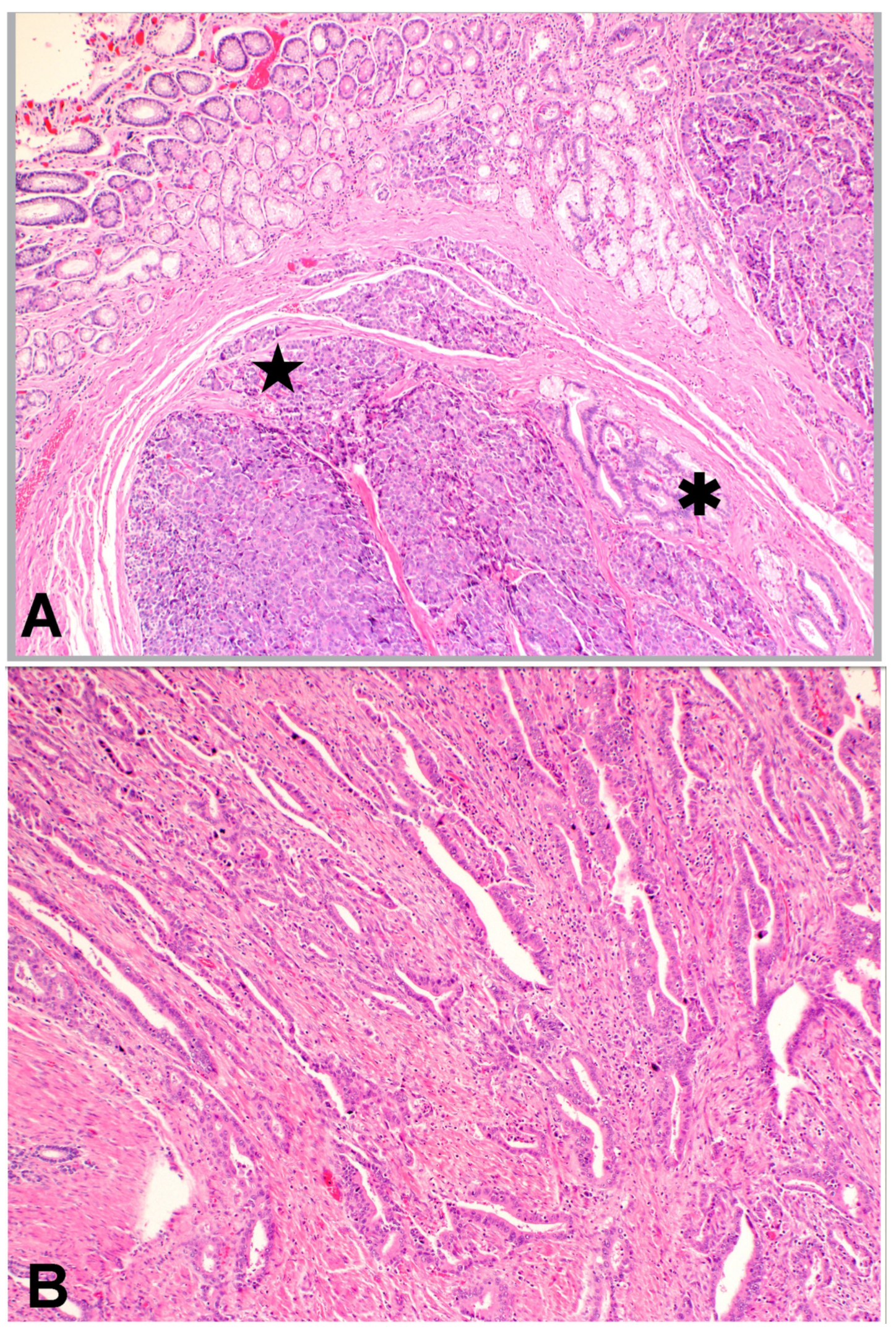 Gastroent 12 00002 g004