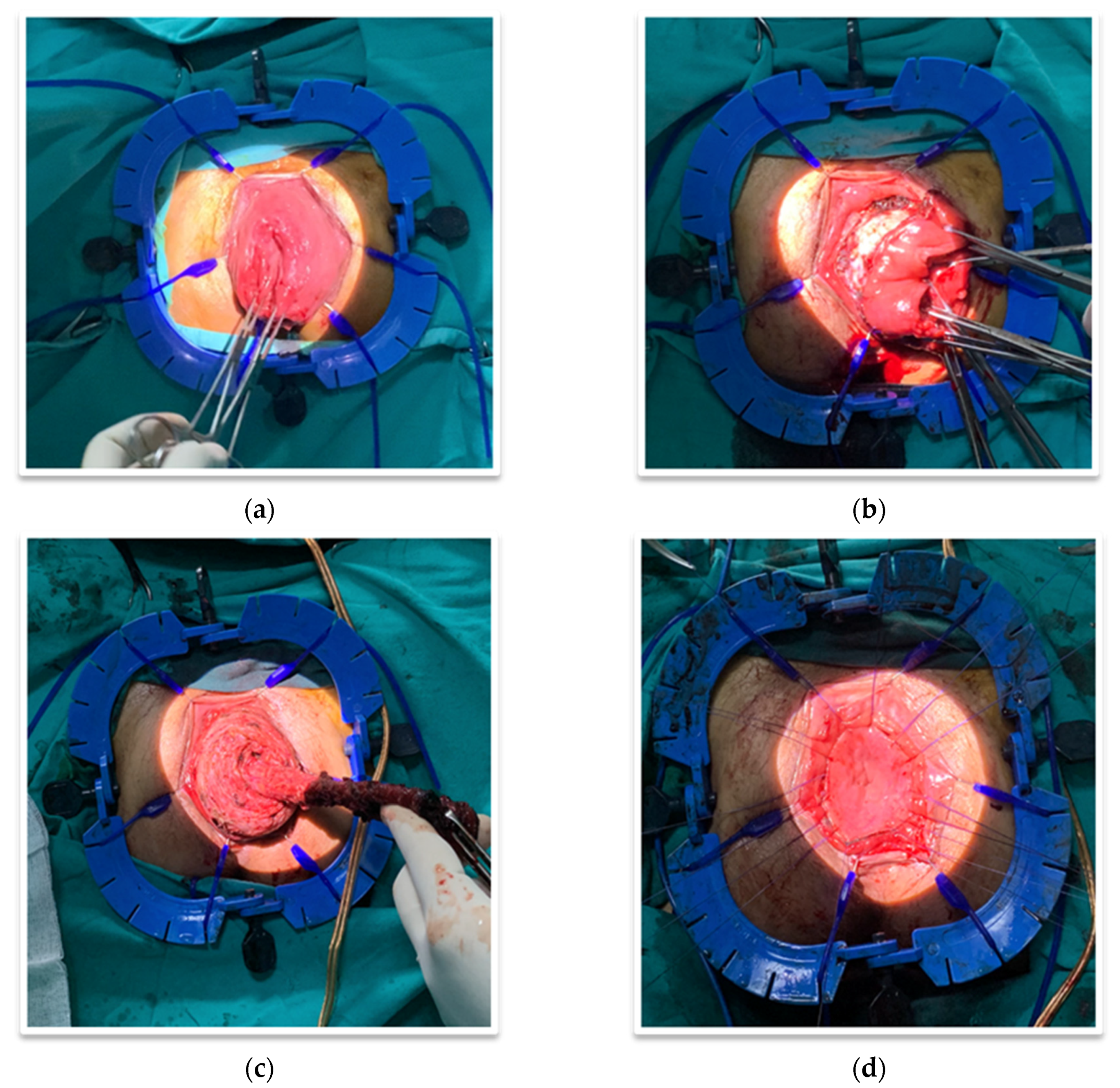 Gastroent 12 00028 g002