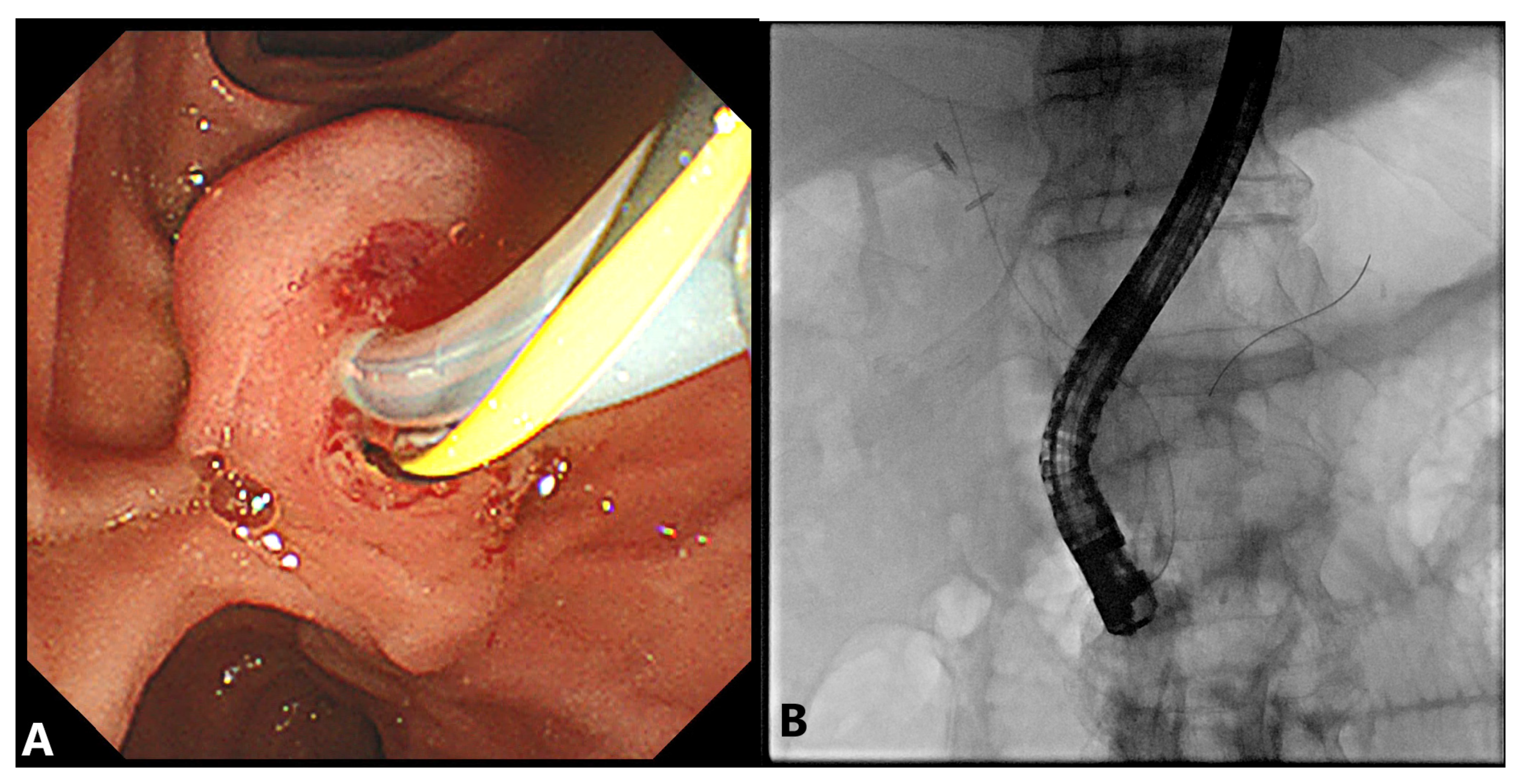 Gastroent 12 00039 g003
