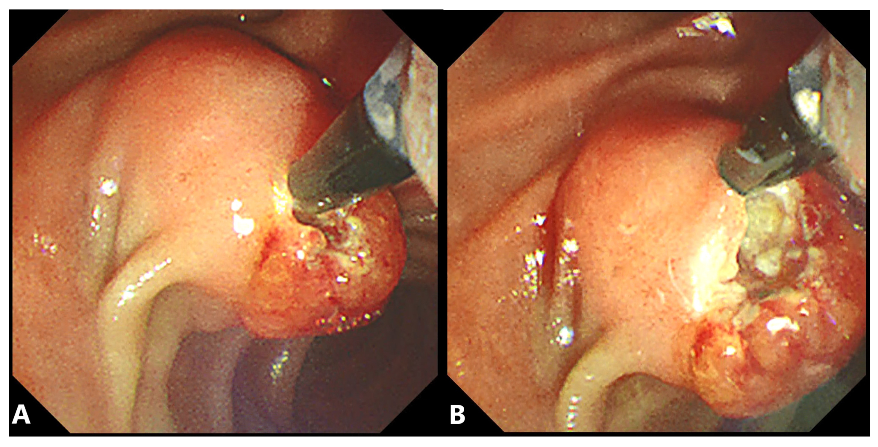 Gastroent 12 00039 g004