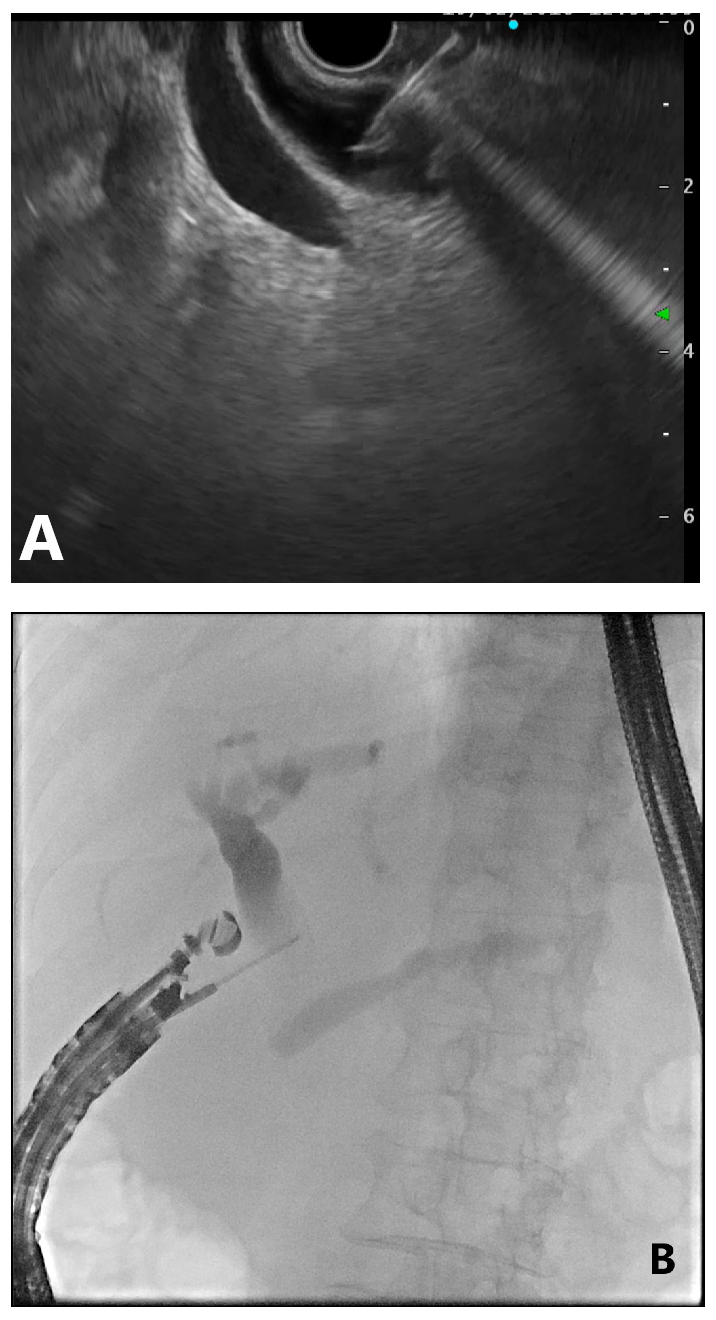 Gastroent 12 00039 g006a