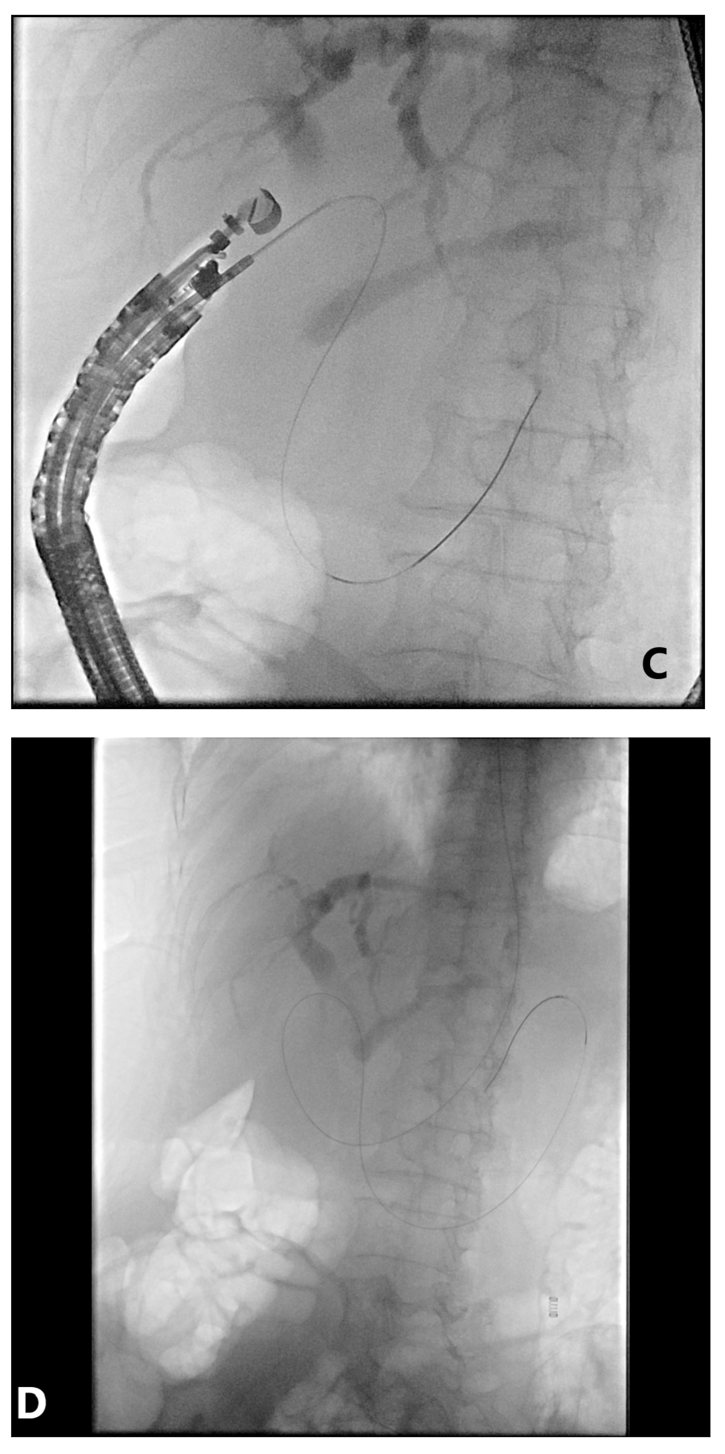 Gastroent 12 00039 g006b