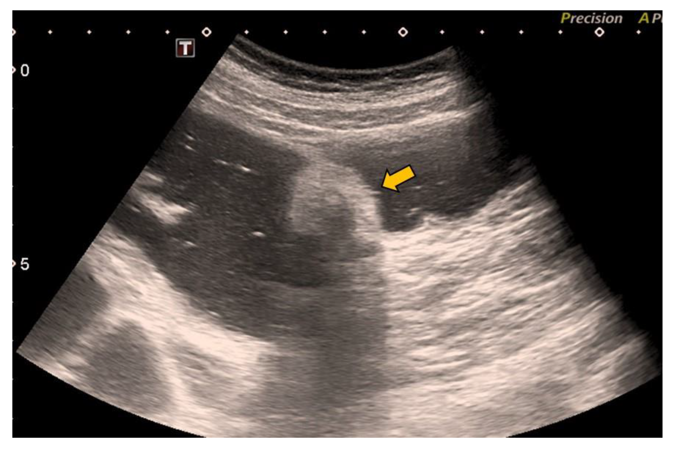 Gastroent 13 00018 g004 Gastroent 13 00018 g004