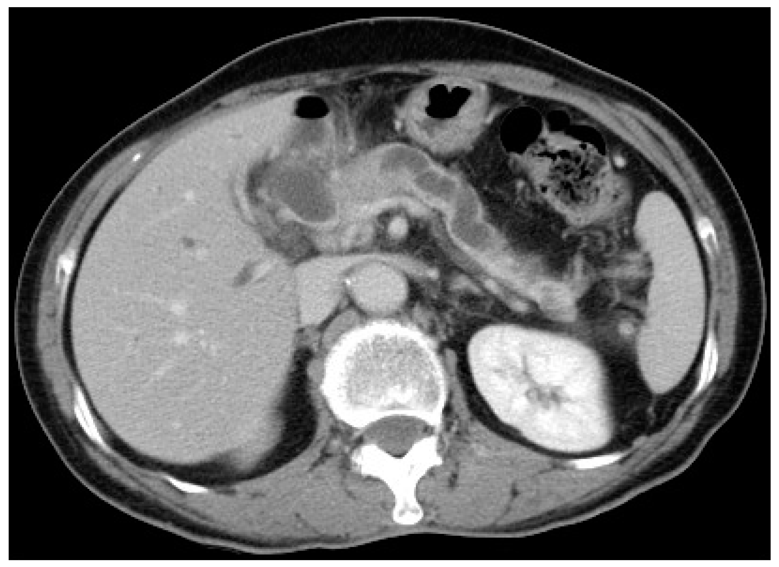 Gastroent 13 00020 g001