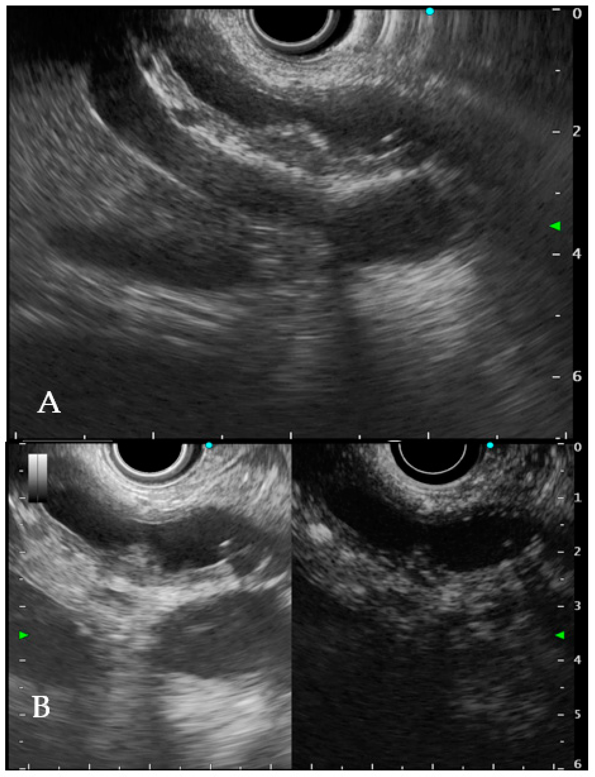 Gastroent 13 00020 g002