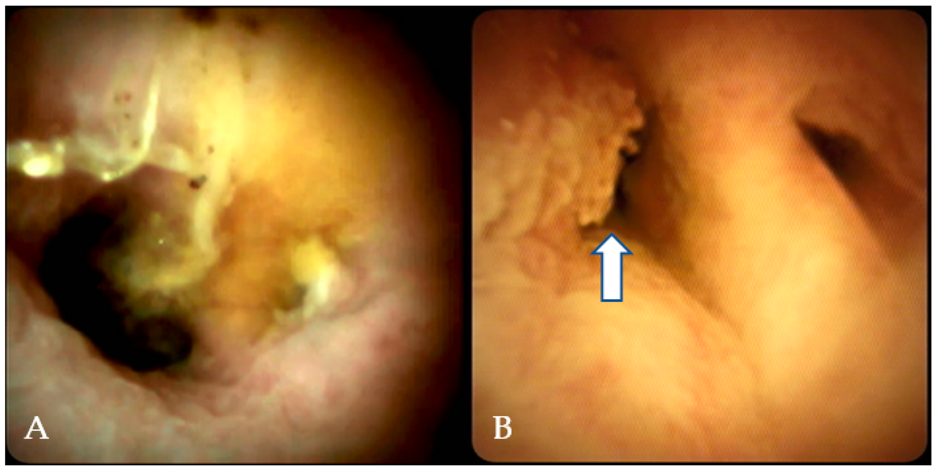 Gastroent 13 00020 g004