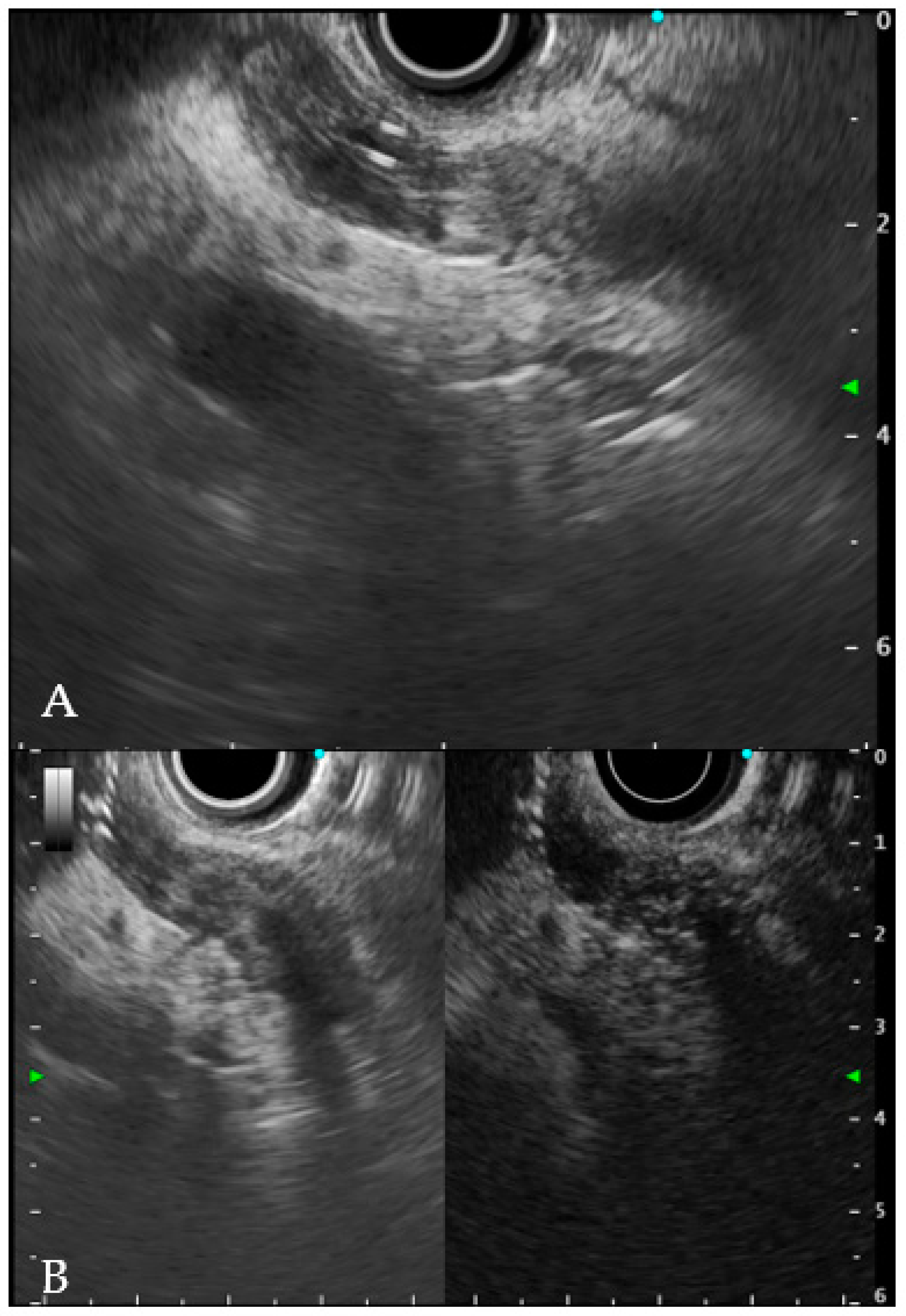 Gastroent 13 00020 g006