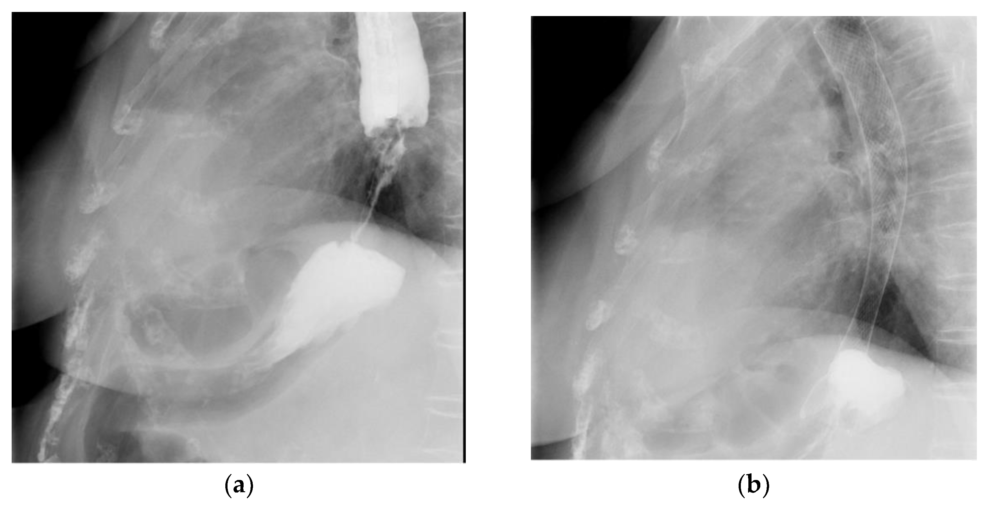 Gastroent 13 00025 g002