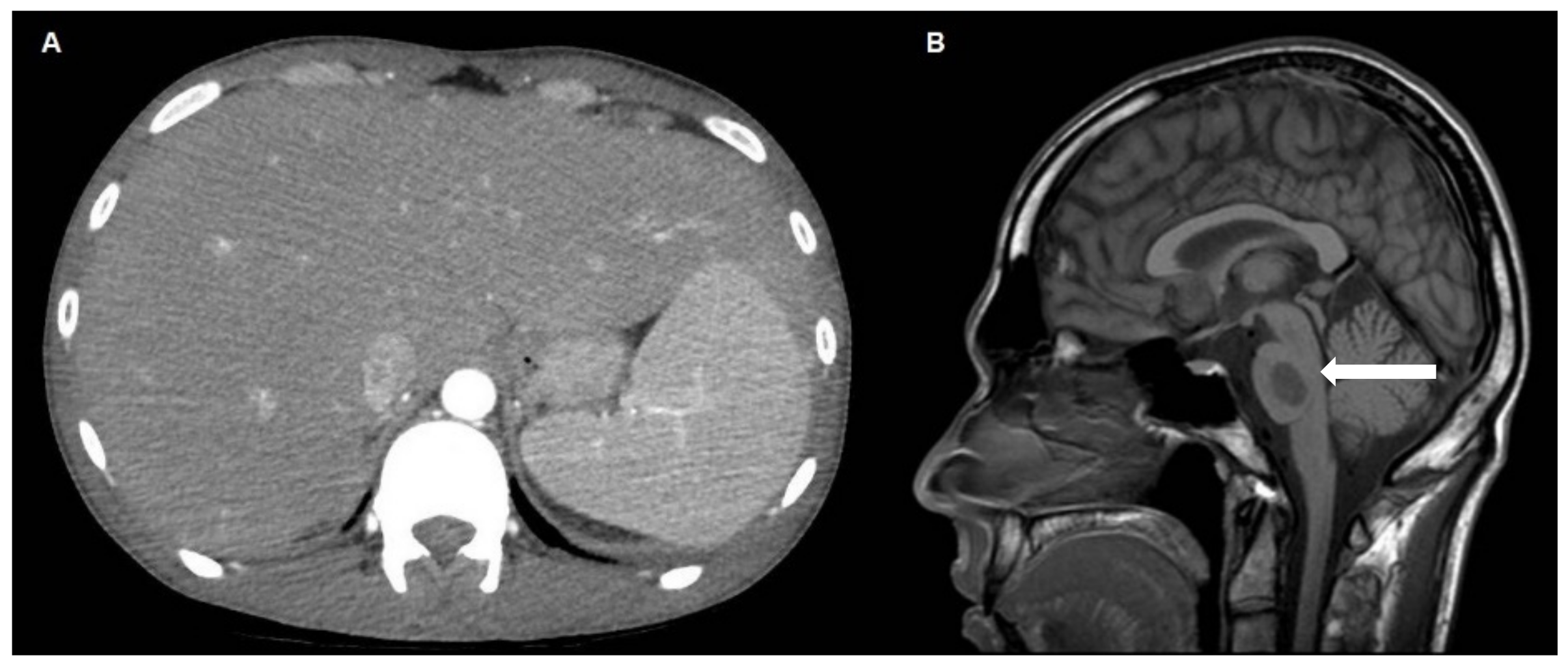 Gastroent 13 00026 g001