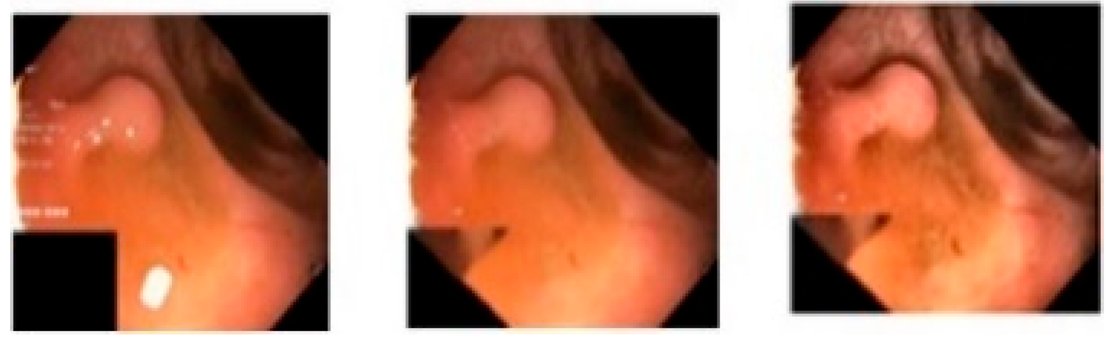 Gastroent 13 00027 g004