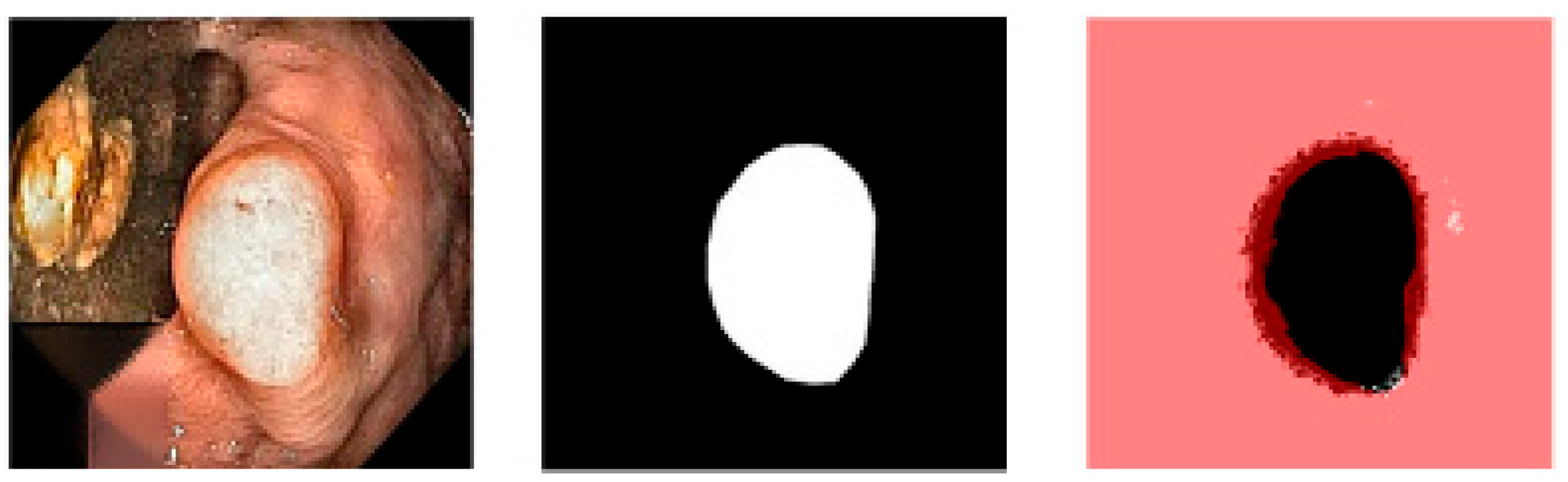 Gastroent 13 00027 g006